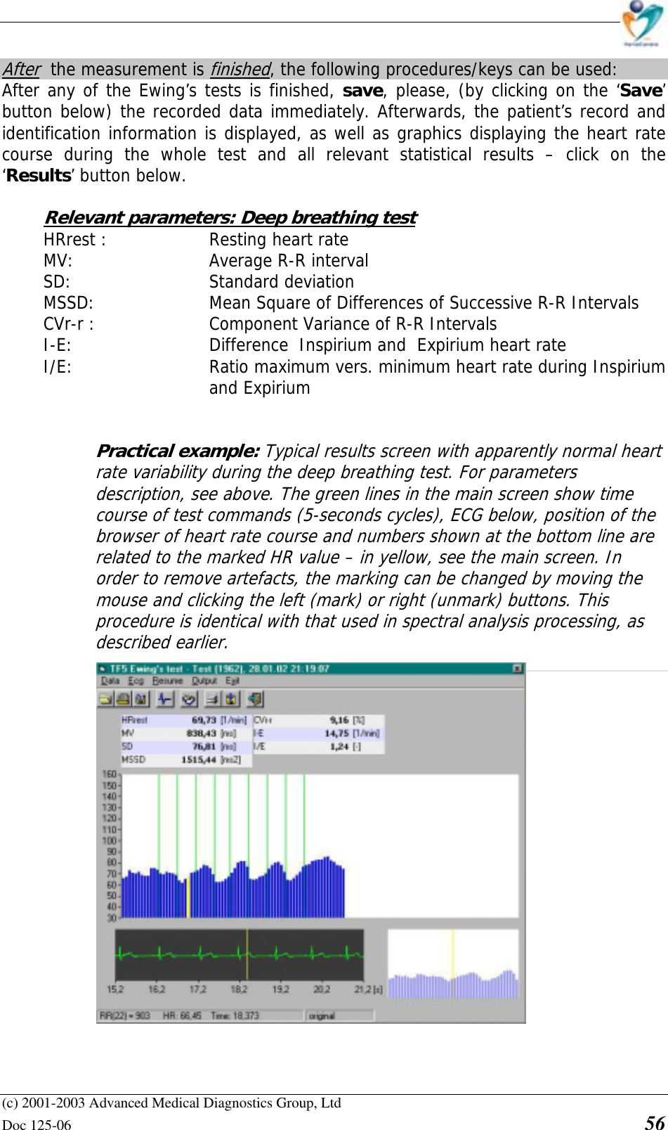    (c) 2001-2003 Advanced Medical Diagnostics Group, Ltd Doc 125-06    56 After  the measurement is finished, the following procedures/keys can be used: After any of the Ewing’s tests is finished, save, please, (by clicking on the ‘Save’ button below) the recorded data immediately. Afterwards, the patient’s record and identification information is displayed, as well as graphics displaying the heart rate course during the whole test and all relevant statistical results – click on the ‘Results’ button below.  Relevant parameters: Deep breathing test HRrest :     Resting heart rate  MV:       Average R-R interval SD:    Standard deviation MSSD:      Mean Square of Differences of Successive R-R Intervals CVr-r :   Component Variance of R-R Intervals I-E:       Difference  Inspirium and  Expirium heart rate I/E:  Ratio maximum vers. minimum heart rate during Inspirium and Expirium   Practical example: Typical results screen with apparently normal heart rate variability during the deep breathing test. For parameters description, see above. The green lines in the main screen show time course of test commands (5-seconds cycles), ECG below, position of the browser of heart rate course and numbers shown at the bottom line are related to the marked HR value – in yellow, see the main screen. In order to remove artefacts, the marking can be changed by moving the mouse and clicking the left (mark) or right (unmark) buttons. This procedure is identical with that used in spectral analysis processing, as described earlier. 