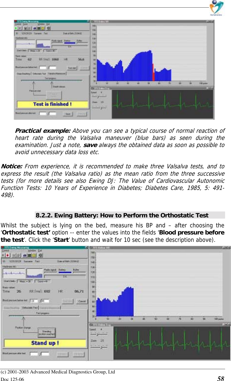    (c) 2001-2003 Advanced Medical Diagnostics Group, Ltd Doc 125-06    58  Practical example: Above you can see a typical course of normal reaction of heart rate during the Valsalva maneuver (blue bars) as seen during the examination. Just a note, save always the obtained data as soon as possible to avoid unnecessary data loss etc.  Notice: From experience, it is recommended to make three Valsalva tests, and to express the result (the Valsalva ratio) as the mean ratio from the three successive tests (for more details see also Ewing DJ: The Value of Cardiovascular Autonomic Function Tests: 10 Years of Experience in Diabetes; Diabetes Care, 1985, 5: 491-498).  8.2.2. Ewing Battery: How to Perform the Orthostatic Test Whilst the subject is lying on the bed, measure his BP and – after choosing the ‘Orthostatic test’ option -- enter the values into the fields ‘Blood pressure before the test’. Click the ‘Start’ button and wait for 10 sec (see the description above).  