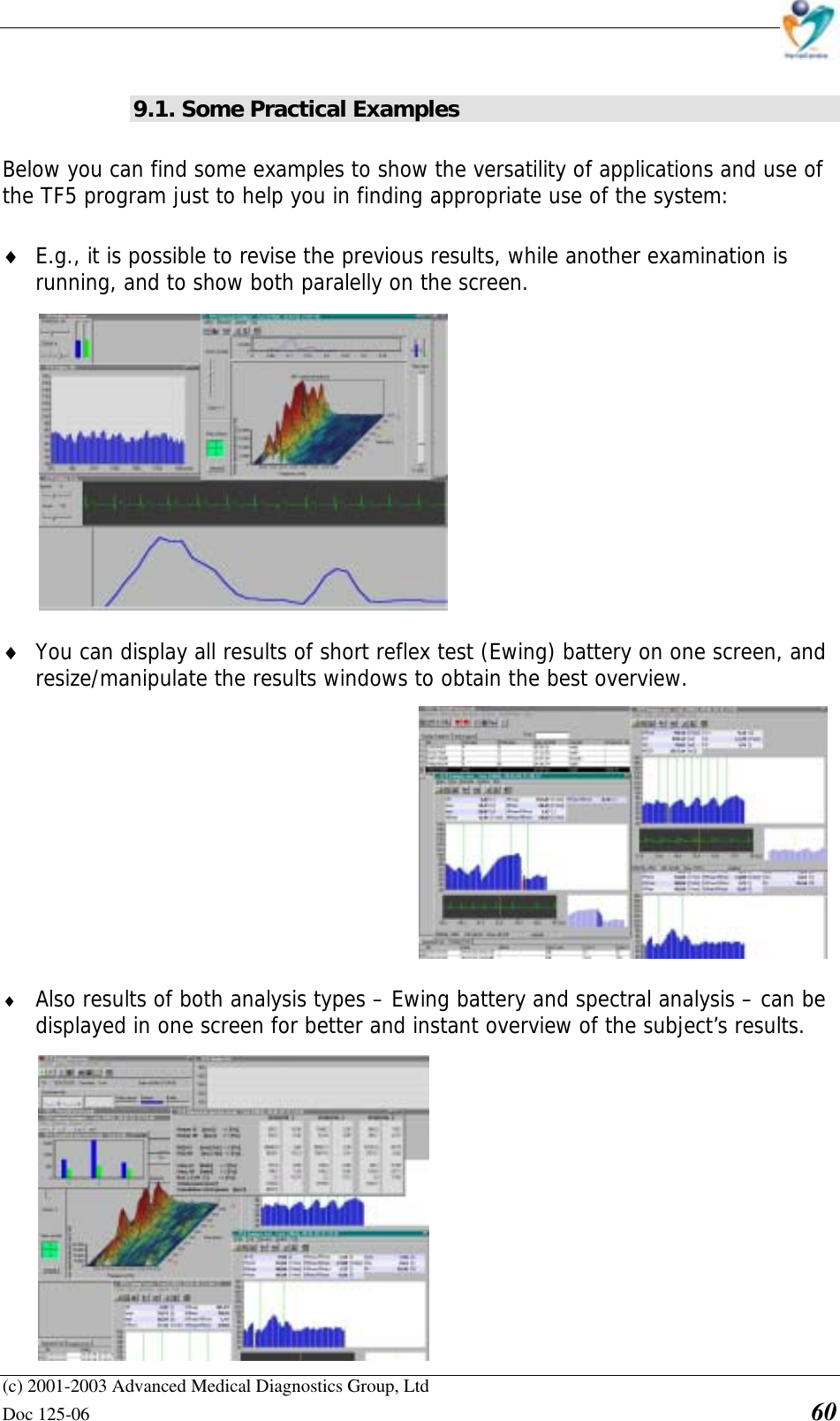    (c) 2001-2003 Advanced Medical Diagnostics Group, Ltd Doc 125-06    60 9.1. Some Practical Examples Below you can find some examples to show the versatility of applications and use of the TF5 program just to help you in finding appropriate use of the system: ♦ E.g., it is possible to revise the previous results, while another examination is running, and to show both paralelly on the screen.  ♦ You can display all results of short reflex test (Ewing) battery on one screen, and resize/manipulate the results windows to obtain the best overview.  ♦ Also results of both analysis types – Ewing battery and spectral analysis – can be displayed in one screen for better and instant overview of the subject’s results. 