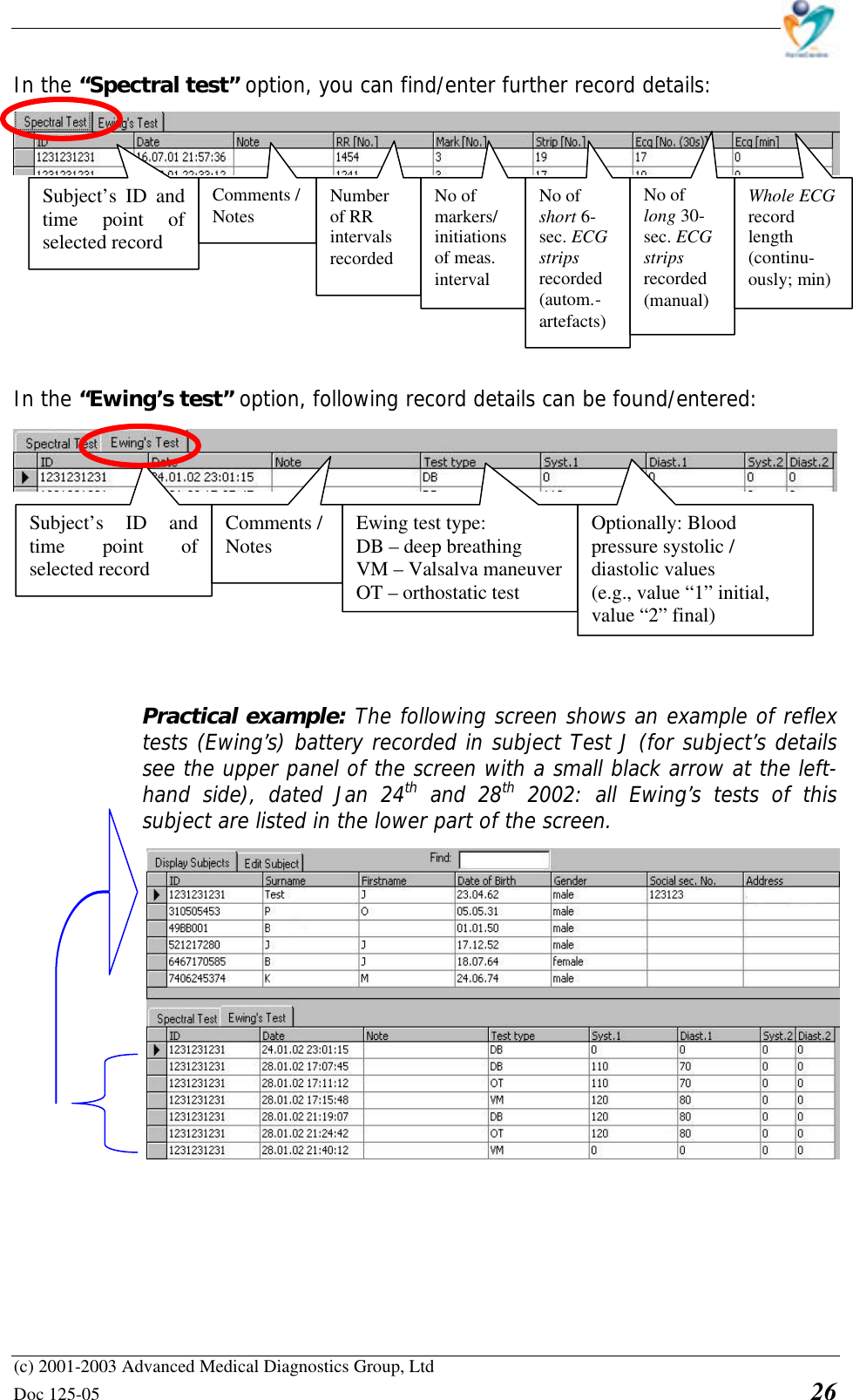    (c) 2001-2003 Advanced Medical Diagnostics Group, Ltd Doc 125-05    26 In the “Spectral test” option, you can find/enter further record details:          In the “Ewing’s test” option, following record details can be found/entered:          Practical example: The following screen shows an example of reflex tests (Ewing’s) battery recorded in subject Test J (for subject’s details see the upper panel of the screen with a small black arrow at the left-hand side), dated Jan 24th and 28th 2002: all Ewing’s tests of this subject are listed in the lower part of the screen.   Subject’s ID and time point of selected record  Comments / Notes Subject’s ID and time point of selected record  Comments / Notes Number  of RR intervals recorded No of  markers/ initiations of meas. interval No of short 6-sec. ECG strips recorded (autom.- artefacts) No of long 30-sec. ECG strips recorded (manual) Whole ECG record length (continu-ously; min) Ewing test type: DB – deep breathing VM – Valsalva maneuver OT – orthostatic test Optionally: Blood pressure systolic / diastolic values (e.g., value “1” initial, value “2” final) 