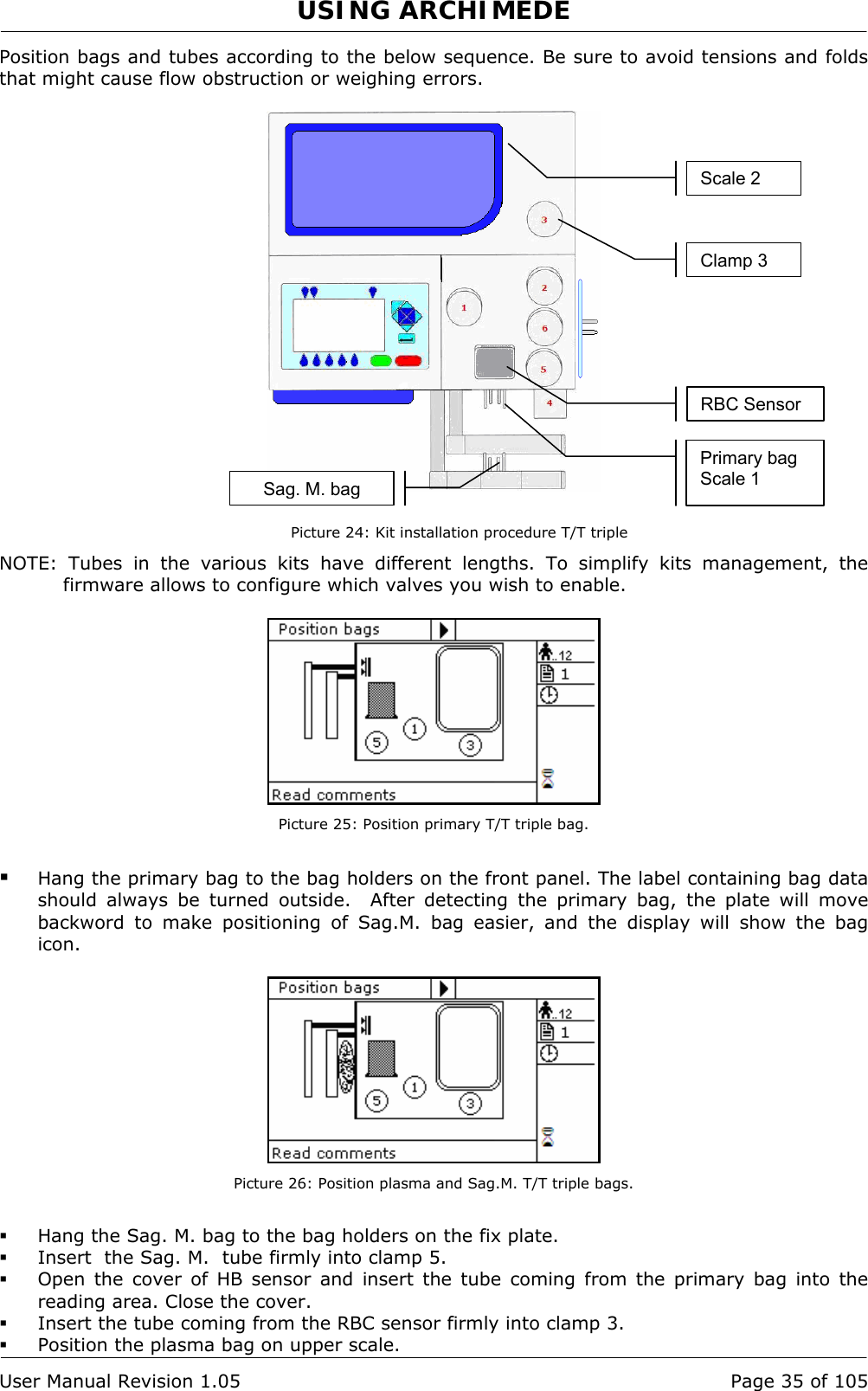 USING ARCHIMEDE   User Manual Revision 1.05  Page 35 of 105 Position bags and tubes according to the below sequence. Be sure to avoid tensions and folds that might cause flow obstruction or weighing errors.     Picture 24: Kit installation procedure T/T triple NOTE: Tubes in the various kits have different lengths. To simplify kits management, the firmware allows to configure which valves you wish to enable.   Picture 25: Position primary T/T triple bag.   Hang the primary bag to the bag holders on the front panel. The label containing bag data should always be turned outside.  After detecting the primary bag, the plate will move backword to make positioning of Sag.M. bag easier, and the display will show the bag icon.   Picture 26: Position plasma and Sag.M. T/T triple bags.  Hang the Sag. M. bag to the bag holders on the fix plate.  Insert  the Sag. M.  tube firmly into clamp 5.  Open the cover of HB sensor and insert the tube coming from the primary bag into the reading area. Close the cover.  Insert the tube coming from the RBC sensor firmly into clamp 3.  Position the plasma bag on upper scale. Primary bag Scale 1 Sag. M. bagRBC SensorClamp 3 Scale 2 