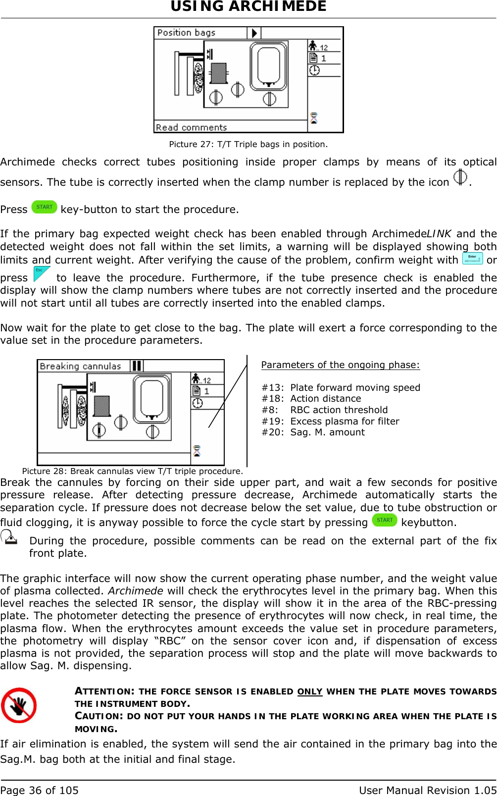 USING ARCHIMEDE   Page 36 of 105  User Manual Revision 1.05  Picture 27: T/T Triple bags in position. Archimede checks correct tubes positioning inside proper clamps by means of its optical sensors. The tube is correctly inserted when the clamp number is replaced by the icon  .  Press   key-button to start the procedure.  If the primary bag expected weight check has been enabled through ArchimedeLINK and the detected weight does not fall within the set limits, a warning will be displayed showing both limits and current weight. After verifying the cause of the problem, confirm weight with   or press   to leave the procedure. Furthermore, if the tube presence check is enabled the display will show the clamp numbers where tubes are not correctly inserted and the procedure will not start until all tubes are correctly inserted into the enabled clamps.  Now wait for the plate to get close to the bag. The plate will exert a force corresponding to the value set in the procedure parameters.   Picture 28: Break cannulas view T/T triple procedure. Break the cannules by forcing on their side upper part, and wait a few seconds for positive pressure release. After detecting pressure decrease, Archimede automatically starts the separation cycle. If pressure does not decrease below the set value, due to tube obstruction or fluid clogging, it is anyway possible to force the cycle start by pressing   keybutton.    During the procedure, possible comments can be read on the external part of the fix front plate.   The graphic interface will now show the current operating phase number, and the weight value of plasma collected. Archimede will check the erythrocytes level in the primary bag. When this level reaches the selected IR sensor, the display will show it in the area of the RBC-pressing plate. The photometer detecting the presence of erythrocytes will now check, in real time, the plasma flow. When the erythrocytes amount exceeds the value set in procedure parameters, the photometry will display “RBC” on the sensor cover icon and, if dispensation of excess plasma is not provided, the separation process will stop and the plate will move backwards to allow Sag. M. dispensing.  ATTENTION: THE FORCE SENSOR IS ENABLED ONLY WHEN THE PLATE MOVES TOWARDS THE INSTRUMENT BODY. CAUTION: DO NOT PUT YOUR HANDS IN THE PLATE WORKING AREA WHEN THE PLATE IS MOVING. If air elimination is enabled, the system will send the air contained in the primary bag into the Sag.M. bag both at the initial and final stage. Parameters of the ongoing phase:  #13:  Plate forward moving speed #18:  Action distance  #8:  RBC action threshold #19:  Excess plasma for filter #20:  Sag. M. amount   