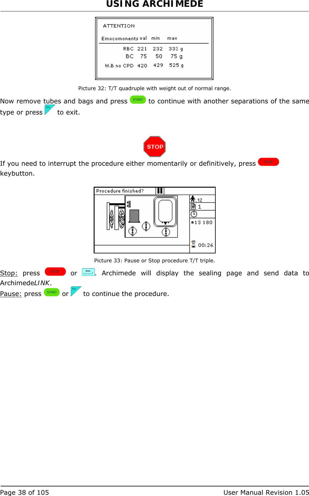 USING ARCHIMEDE   Page 38 of 105  User Manual Revision 1.05  Picture 32: T/T quadruple with weight out of normal range. Now remove tubes and bags and press   to continue with another separations of the same type or press   to exit.    If you need to interrupt the procedure either momentarily or definitively, press   keybutton.   Picture 33: Pause or Stop procedure T/T triple. Stop: press   or  . Archimede will display the sealing page and send data to ArchimedeLINK. Pause: press   or   to continue the procedure.  