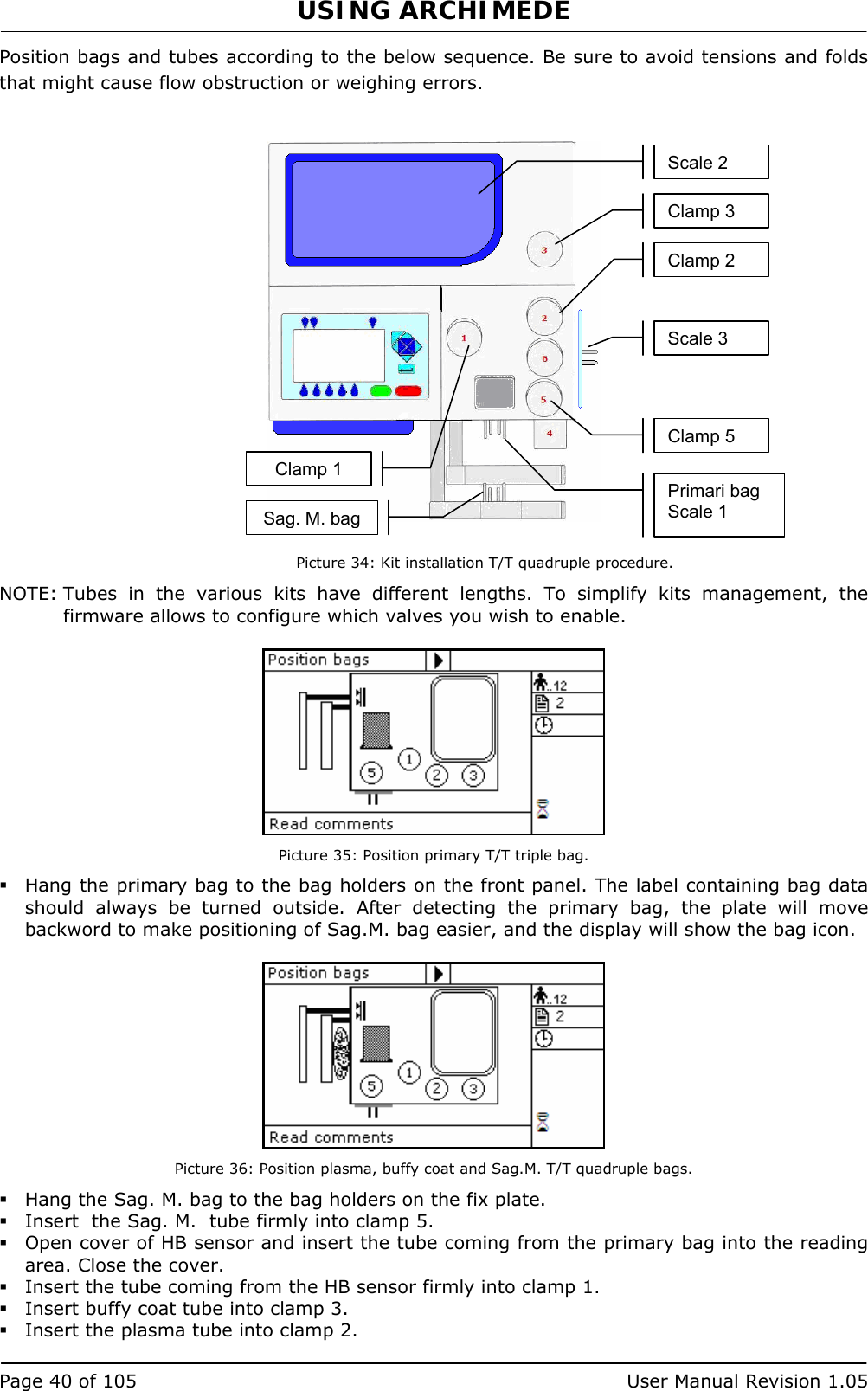 USING ARCHIMEDE   Page 40 of 105  User Manual Revision 1.05 Position bags and tubes according to the below sequence. Be sure to avoid tensions and folds that might cause flow obstruction or weighing errors.     Picture 34: Kit installation T/T quadruple procedure. NOTE: Tubes in the various kits have different lengths. To simplify kits management, the firmware allows to configure which valves you wish to enable.   Picture 35: Position primary T/T triple bag.  Hang the primary bag to the bag holders on the front panel. The label containing bag data should always be turned outside. After detecting the primary bag, the plate will move backword to make positioning of Sag.M. bag easier, and the display will show the bag icon.   Picture 36: Position plasma, buffy coat and Sag.M. T/T quadruple bags.  Hang the Sag. M. bag to the bag holders on the fix plate.  Insert  the Sag. M.  tube firmly into clamp 5.  Open cover of HB sensor and insert the tube coming from the primary bag into the reading area. Close the cover.  Insert the tube coming from the HB sensor firmly into clamp 1.  Insert buffy coat tube into clamp 3.  Insert the plasma tube into clamp 2. Primari bag Scale 1 Sag. M. bagClamp 2 Scale 2 Clamp 3 Scale 3 Clamp 1Clamp 5 