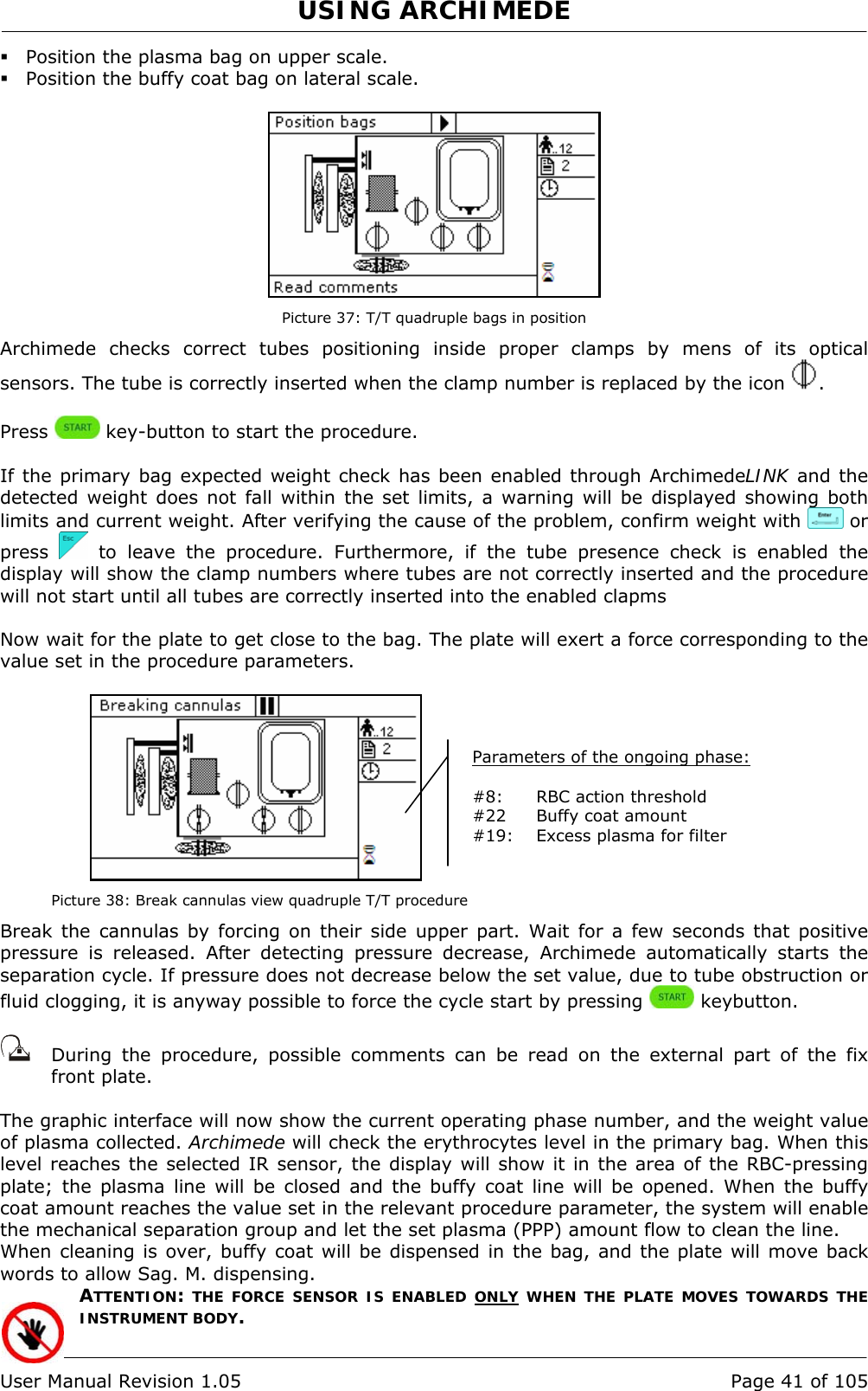 USING ARCHIMEDE   User Manual Revision 1.05  Page 41 of 105  Position the plasma bag on upper scale.  Position the buffy coat bag on lateral scale.   Picture 37: T/T quadruple bags in position Archimede checks correct tubes positioning inside proper clamps by mens of its optical sensors. The tube is correctly inserted when the clamp number is replaced by the icon  .  Press   key-button to start the procedure.  If the primary bag expected weight check has been enabled through ArchimedeLINK and the detected weight does not fall within the set limits, a warning will be displayed showing both limits and current weight. After verifying the cause of the problem, confirm weight with   or press   to leave the procedure. Furthermore, if the tube presence check is enabled the display will show the clamp numbers where tubes are not correctly inserted and the procedure will not start until all tubes are correctly inserted into the enabled clapms  Now wait for the plate to get close to the bag. The plate will exert a force corresponding to the value set in the procedure parameters.   Picture 38: Break cannulas view quadruple T/T procedure Break the cannulas by forcing on their side upper part. Wait for a few seconds that positive pressure is released. After detecting pressure decrease, Archimede automatically starts the separation cycle. If pressure does not decrease below the set value, due to tube obstruction or fluid clogging, it is anyway possible to force the cycle start by pressing   keybutton.     During the procedure, possible comments can be read on the external part of the fix front plate.   The graphic interface will now show the current operating phase number, and the weight value of plasma collected. Archimede will check the erythrocytes level in the primary bag. When this level reaches the selected IR sensor, the display will show it in the area of the RBC-pressing plate; the plasma line will be closed and the buffy coat line will be opened. When the buffy coat amount reaches the value set in the relevant procedure parameter, the system will enable the mechanical separation group and let the set plasma (PPP) amount flow to clean the line. When cleaning is over, buffy coat will be dispensed in the bag, and the plate will move back words to allow Sag. M. dispensing. ATTENTION: THE FORCE SENSOR IS ENABLED ONLY WHEN THE PLATE MOVES TOWARDS THE INSTRUMENT BODY. Parameters of the ongoing phase:  #8:  RBC action threshold #22  Buffy coat amount #19:  Excess plasma for filter 