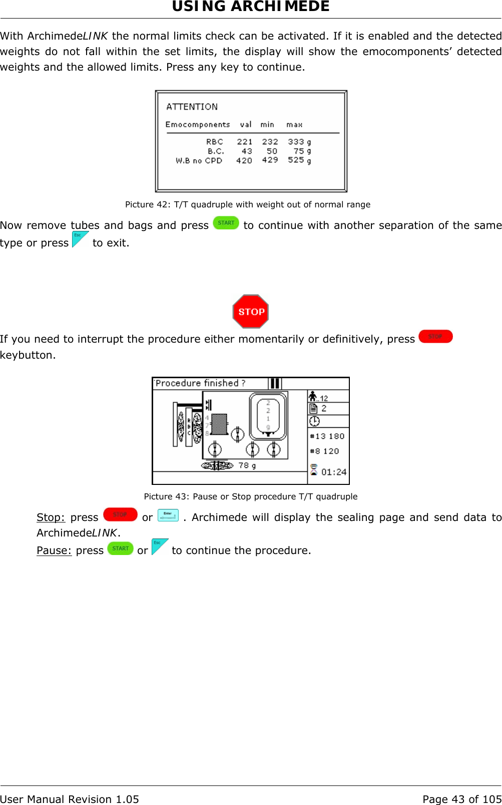 USING ARCHIMEDE   User Manual Revision 1.05  Page 43 of 105 With ArchimedeLINK the normal limits check can be activated. If it is enabled and the detected weights do not fall within the set limits, the display will show the emocomponents’ detected weights and the allowed limits. Press any key to continue.   Picture 42: T/T quadruple with weight out of normal range Now remove tubes and bags and press   to continue with another separation of the same type or press   to exit.     If you need to interrupt the procedure either momentarily or definitively, press   keybutton.   Picture 43: Pause or Stop procedure T/T quadruple Stop: press   or   . Archimede will display the sealing page and send data to ArchimedeLINK. Pause: press   or   to continue the procedure. 