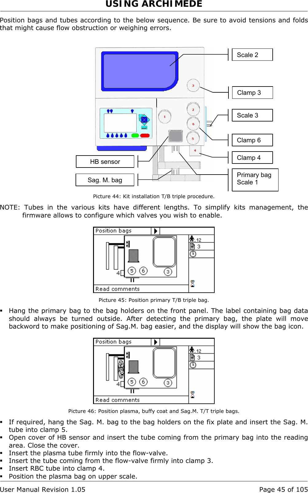 USING ARCHIMEDE   User Manual Revision 1.05  Page 45 of 105 Position bags and tubes according to the below sequence. Be sure to avoid tensions and folds that might cause flow obstruction or weighing errors.     Picture 44: Kit installation T/B triple procedure. NOTE: Tubes in the various kits have different lengths. To simplify kits management, the firmware allows to configure which valves you wish to enable.   Picture 45: Position primary T/B triple bag.  Hang the primary bag to the bag holders on the front panel. The label containing bag data should always be turned outside. After detecting the primary bag, the plate will move backword to make positioning of Sag.M. bag easier, and the display will show the bag icon.   Picture 46: Position plasma, buffy coat and Sag.M. T/T triple bags.  If required, hang the Sag. M. bag to the bag holders on the fix plate and insert the Sag. M. tube into clamp 5.  Open cover of HB sensor and insert the tube coming from the primary bag into the reading area. Close the cover.  Insert the plasma tube firmly into the flow-valve.  Insert the tube coming from the flow-valve firmly into clamp 3.  Insert RBC tube into clamp 4.  Position the plasma bag on upper scale. Primary bag Scale 1 Sag. M. bagScale 2 Scale 3 Clamp 3 Clamp 6 Clamp 4 HB sensor 