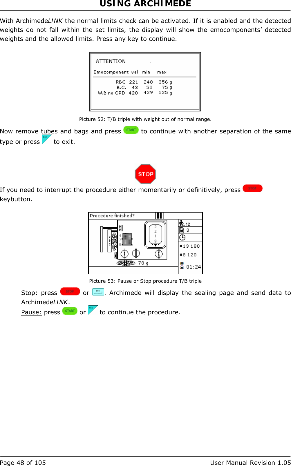 USING ARCHIMEDE   Page 48 of 105  User Manual Revision 1.05 With ArchimedeLINK the normal limits check can be activated. If it is enabled and the detected weights do not fall within the set limits, the display will show the emocomponents’ detected weights and the allowed limits. Press any key to continue.   Picture 52: T/B triple with weight out of normal range. Now remove tubes and bags and press   to continue with another separation of the same type or press   to exit.    If you need to interrupt the procedure either momentarily or definitively, press   keybutton.   Picture 53: Pause or Stop procedure T/B triple Stop: press   or  . Archimede will display the sealing page and send data to ArchimedeLINK. Pause: press   or   to continue the procedure. 