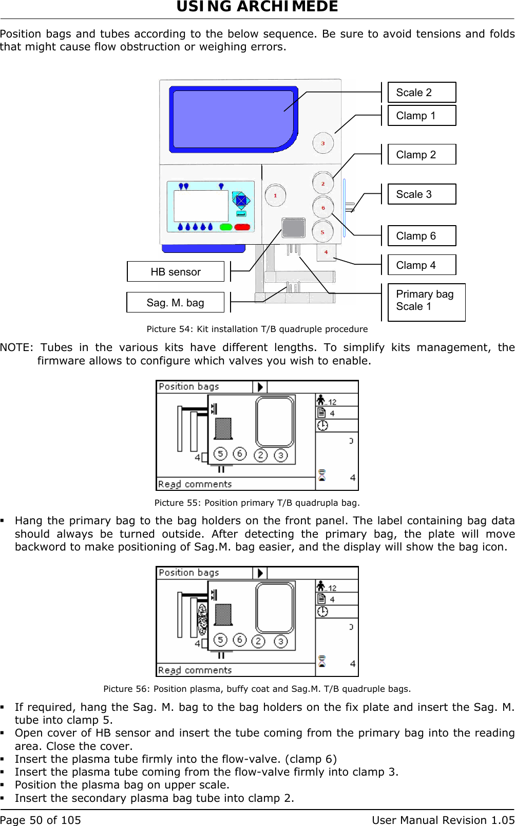 USING ARCHIMEDE   Page 50 of 105  User Manual Revision 1.05 Position bags and tubes according to the below sequence. Be sure to avoid tensions and folds that might cause flow obstruction or weighing errors.     Picture 54: Kit installation T/B quadruple procedure NOTE: Tubes in the various kits have different lengths. To simplify kits management, the firmware allows to configure which valves you wish to enable.   Picture 55: Position primary T/B quadrupla bag.  Hang the primary bag to the bag holders on the front panel. The label containing bag data should always be turned outside. After detecting the primary bag, the plate will move backword to make positioning of Sag.M. bag easier, and the display will show the bag icon.   Picture 56: Position plasma, buffy coat and Sag.M. T/B quadruple bags.  If required, hang the Sag. M. bag to the bag holders on the fix plate and insert the Sag. M. tube into clamp 5.  Open cover of HB sensor and insert the tube coming from the primary bag into the reading area. Close the cover.  Insert the plasma tube firmly into the flow-valve. (clamp 6)  Insert the plasma tube coming from the flow-valve firmly into clamp 3.  Position the plasma bag on upper scale.  Insert the secondary plasma bag tube into clamp 2. Primary bag Scale 1 Sag. M. bagScale 2 Scale 3 Clamp 1 Clamp 6 Clamp 4 HB sensor Clamp 2 