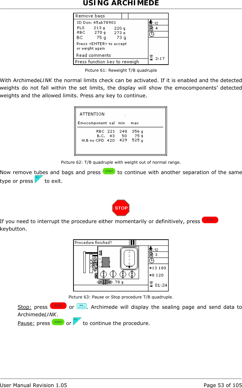 USING ARCHIMEDE   User Manual Revision 1.05  Page 53 of 105  Picture 61: Reweight T/B quadruple With ArchimedeLINK the normal limits check can be activated. If it is enabled and the detected weights do not fall within the set limits, the display will show the emocomponents’ detected weights and the allowed limits. Press any key to continue.   Picture 62: T/B quadruple with weight out of normal range. Now remove tubes and bags and press   to continue with another separation of the same type or press   to exit.    If you need to interrupt the procedure either momentarily or definitively, press   keybutton.   Picture 63: Pause or Stop procedure T/B quadruple. Stop: press   or  . Archimede will display the sealing page and send data to ArchimedeLINK. Pause: press   or   to continue the procedure. 