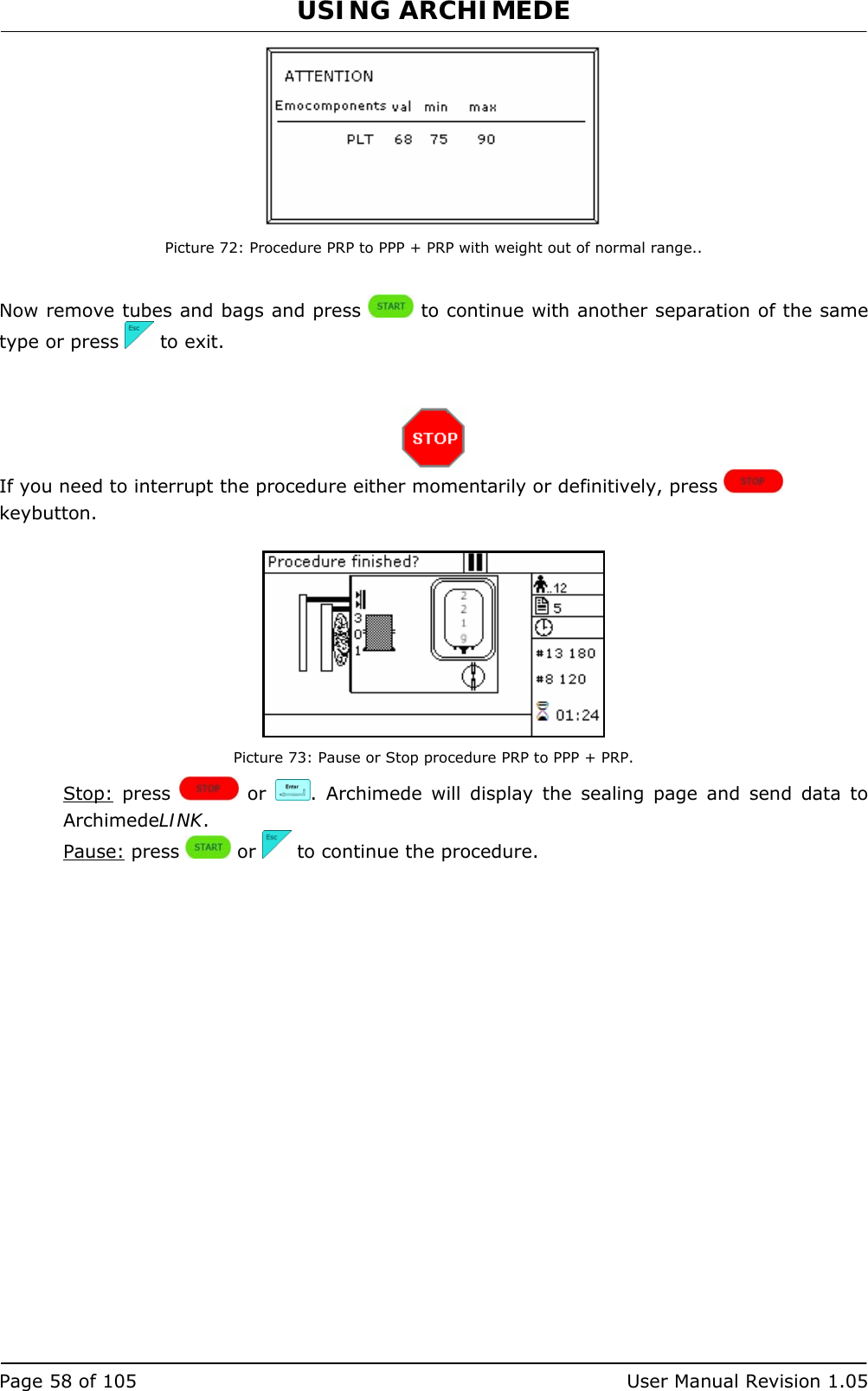 USING ARCHIMEDE   Page 58 of 105  User Manual Revision 1.05  Picture 72: Procedure PRP to PPP + PRP with weight out of normal range..  Now remove tubes and bags and press   to continue with another separation of the same type or press   to exit.    If you need to interrupt the procedure either momentarily or definitively, press   keybutton.   Picture 73: Pause or Stop procedure PRP to PPP + PRP. Stop: press   or  . Archimede will display the sealing page and send data to ArchimedeLINK. Pause: press   or   to continue the procedure. 