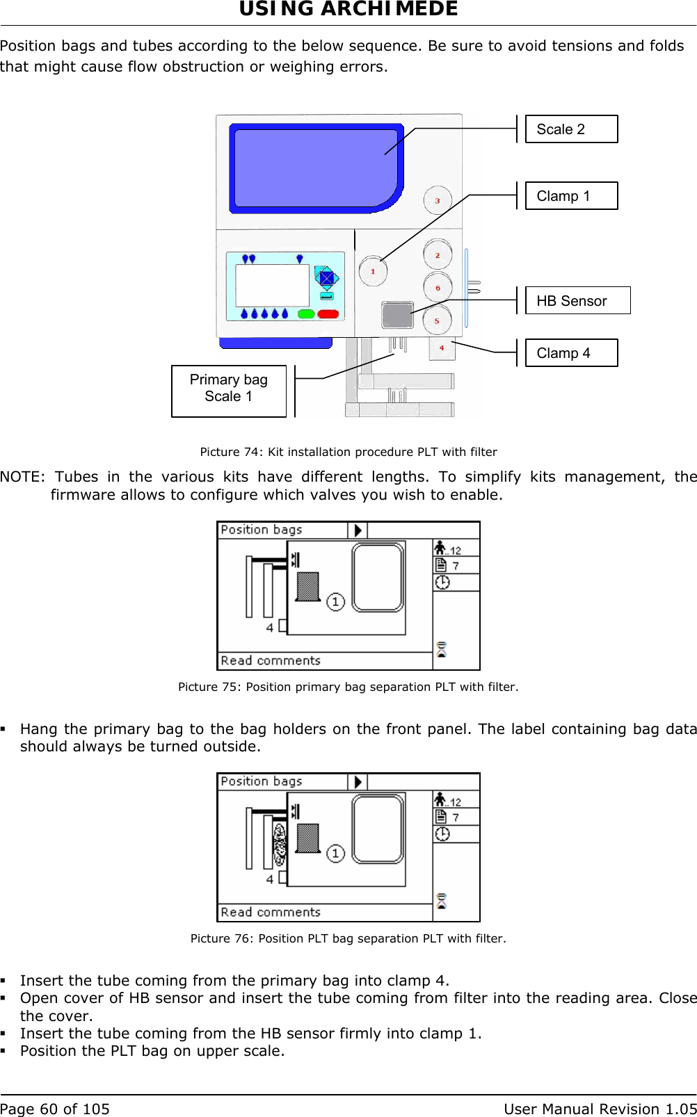 USING ARCHIMEDE   Page 60 of 105  User Manual Revision 1.05 Position bags and tubes according to the below sequence. Be sure to avoid tensions and folds that might cause flow obstruction or weighing errors.     Picture 74: Kit installation procedure PLT with filter NOTE: Tubes in the various kits have different lengths. To simplify kits management, the firmware allows to configure which valves you wish to enable.   Picture 75: Position primary bag separation PLT with filter.   Hang the primary bag to the bag holders on the front panel. The label containing bag data should always be turned outside.   Picture 76: Position PLT bag separation PLT with filter.   Insert the tube coming from the primary bag into clamp 4.  Open cover of HB sensor and insert the tube coming from filter into the reading area. Close the cover.  Insert the tube coming from the HB sensor firmly into clamp 1.  Position the PLT bag on upper scale. Primary bag Scale 1 HB Sensor Scale 2 Clamp 1 Clamp 4 