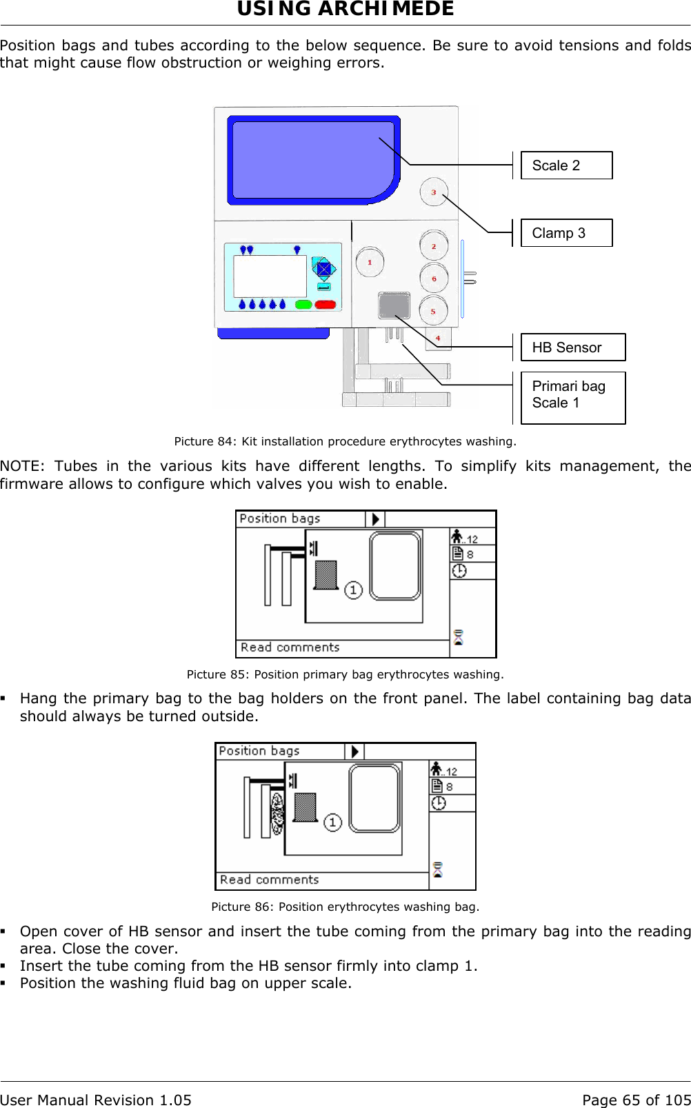 USING ARCHIMEDE   User Manual Revision 1.05  Page 65 of 105 Position bags and tubes according to the below sequence. Be sure to avoid tensions and folds that might cause flow obstruction or weighing errors.     Picture 84: Kit installation procedure erythrocytes washing. NOTE: Tubes in the various kits have different lengths. To simplify kits management, the firmware allows to configure which valves you wish to enable.   Picture 85: Position primary bag erythrocytes washing.  Hang the primary bag to the bag holders on the front panel. The label containing bag data should always be turned outside.   Picture 86: Position erythrocytes washing bag.  Open cover of HB sensor and insert the tube coming from the primary bag into the reading area. Close the cover.  Insert the tube coming from the HB sensor firmly into clamp 1.  Position the washing fluid bag on upper scale. Primari bag Scale 1 HB Sensor Clamp 3 Scale 2 