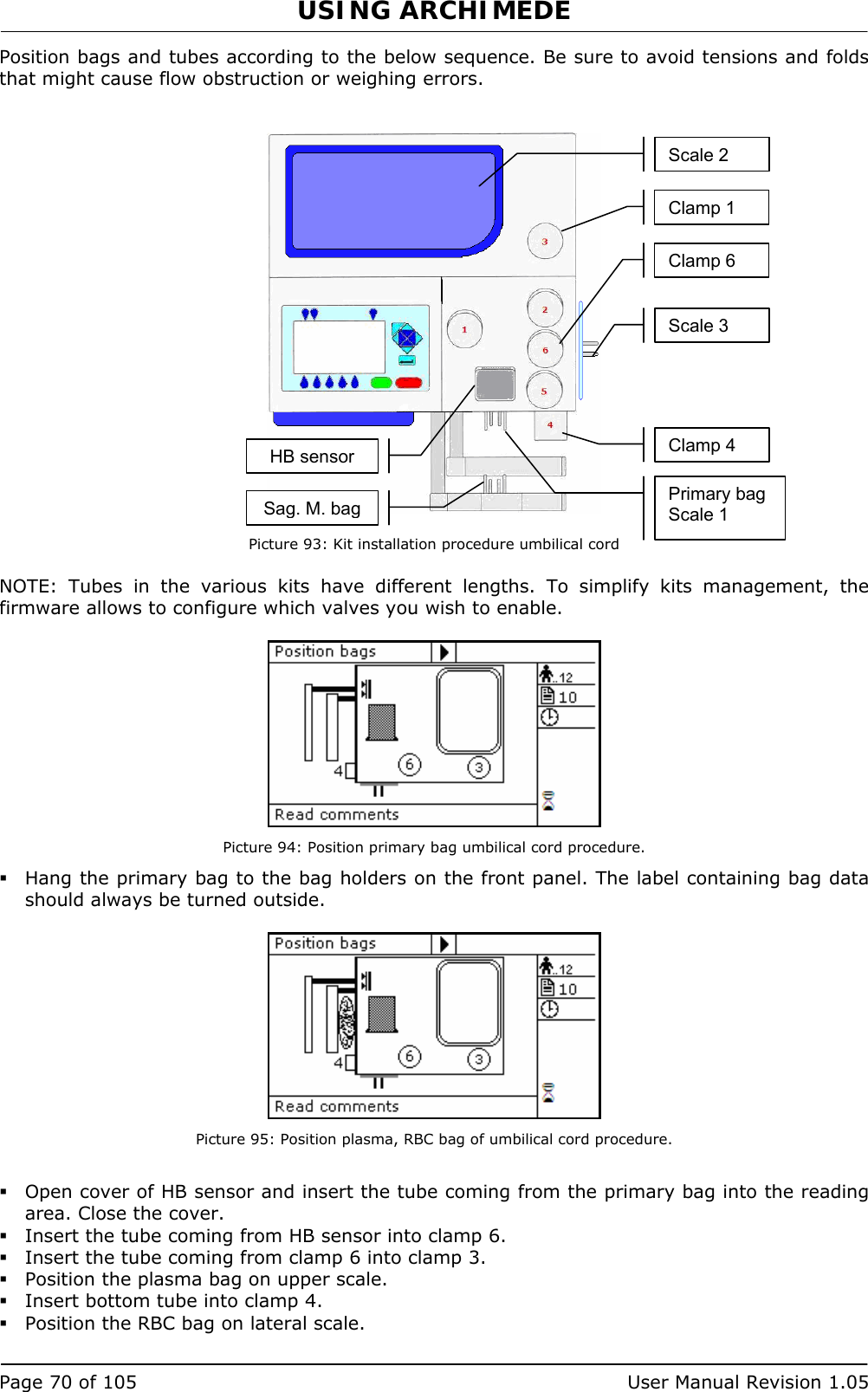 USING ARCHIMEDE   Page 70 of 105  User Manual Revision 1.05 Position bags and tubes according to the below sequence. Be sure to avoid tensions and folds that might cause flow obstruction or weighing errors.     Picture 93: Kit installation procedure umbilical cord  NOTE: Tubes in the various kits have different lengths. To simplify kits management, the firmware allows to configure which valves you wish to enable.   Picture 94: Position primary bag umbilical cord procedure.  Hang the primary bag to the bag holders on the front panel. The label containing bag data should always be turned outside.   Picture 95: Position plasma, RBC bag of umbilical cord procedure.   Open cover of HB sensor and insert the tube coming from the primary bag into the reading area. Close the cover.  Insert the tube coming from HB sensor into clamp 6.  Insert the tube coming from clamp 6 into clamp 3.  Position the plasma bag on upper scale.  Insert bottom tube into clamp 4.  Position the RBC bag on lateral scale. Primary bag Scale 1 Sag. M. bagScale 2 Scale 3 Clamp 1 Clamp 6 Clamp 4 HB sensor