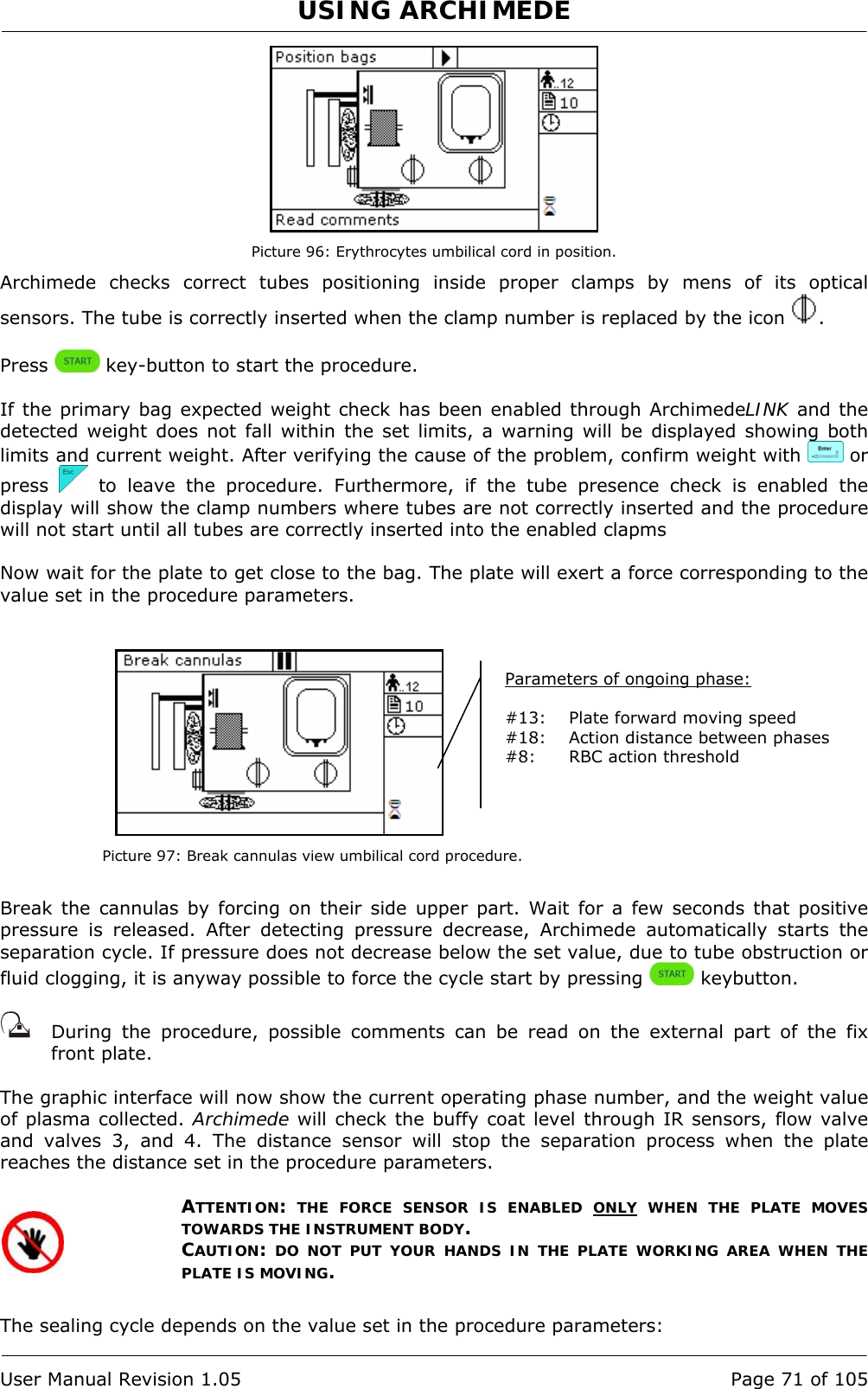 USING ARCHIMEDE   User Manual Revision 1.05  Page 71 of 105  Picture 96: Erythrocytes umbilical cord in position. Archimede checks correct tubes positioning inside proper clamps by mens of its optical sensors. The tube is correctly inserted when the clamp number is replaced by the icon  .  Press   key-button to start the procedure.  If the primary bag expected weight check has been enabled through ArchimedeLINK and the detected weight does not fall within the set limits, a warning will be displayed showing both limits and current weight. After verifying the cause of the problem, confirm weight with   or press   to leave the procedure. Furthermore, if the tube presence check is enabled the display will show the clamp numbers where tubes are not correctly inserted and the procedure will not start until all tubes are correctly inserted into the enabled clapms  Now wait for the plate to get close to the bag. The plate will exert a force corresponding to the value set in the procedure parameters.    Picture 97: Break cannulas view umbilical cord procedure.  Break the cannulas by forcing on their side upper part. Wait for a few seconds that positive pressure is released. After detecting pressure decrease, Archimede automatically starts the separation cycle. If pressure does not decrease below the set value, due to tube obstruction or fluid clogging, it is anyway possible to force the cycle start by pressing   keybutton.     During the procedure, possible comments can be read on the external part of the fix front plate.   The graphic interface will now show the current operating phase number, and the weight value of plasma collected. Archimede will check the buffy coat level through IR sensors, flow valve and valves 3, and 4. The distance sensor will stop the separation process when the plate reaches the distance set in the procedure parameters.  ATTENTION: THE FORCE SENSOR IS ENABLED ONLY WHEN THE PLATE MOVES TOWARDS THE INSTRUMENT BODY. CAUTION: DO NOT PUT YOUR HANDS IN THE PLATE WORKING AREA WHEN THE PLATE IS MOVING.  The sealing cycle depends on the value set in the procedure parameters:  Parameters of ongoing phase:  #13:  Plate forward moving speed #18:  Action distance between phases #8:  RBC action threshold 