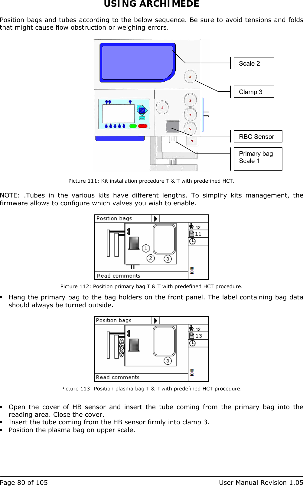 USING ARCHIMEDE   Page 80 of 105  User Manual Revision 1.05 Position bags and tubes according to the below sequence. Be sure to avoid tensions and folds that might cause flow obstruction or weighing errors.     Picture 111: Kit installation procedure T &amp; T with predefined HCT.  NOTE: .Tubes in the various kits have different lengths. To simplify kits management, the firmware allows to configure which valves you wish to enable.   Picture 112: Position primary bag T &amp; T with predefined HCT procedure.  Hang the primary bag to the bag holders on the front panel. The label containing bag data should always be turned outside.   Picture 113: Position plasma bag T &amp; T with predefined HCT procedure.   Open the cover of HB sensor and insert the tube coming from the primary bag into the reading area. Close the cover.  Insert the tube coming from the HB sensor firmly into clamp 3.  Position the plasma bag on upper scale. Primary bag Scale 1 RBC SensorClamp 3 Scale 2 