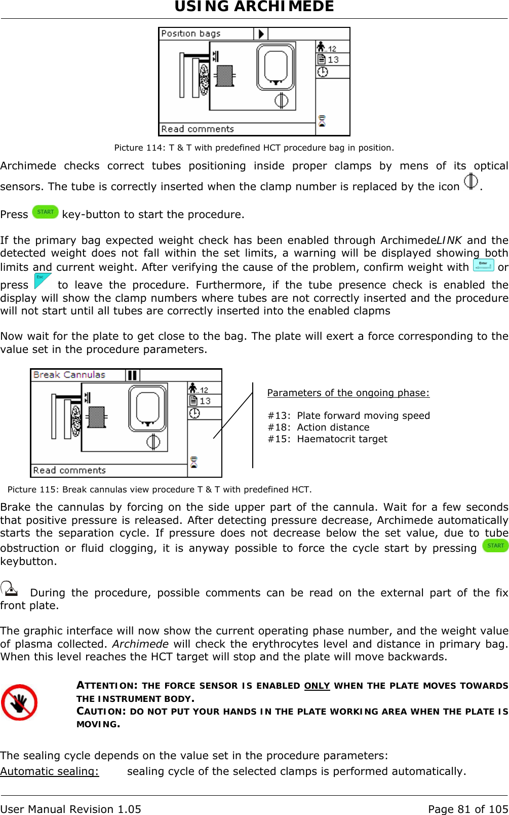 USING ARCHIMEDE   User Manual Revision 1.05  Page 81 of 105  Picture 114: T &amp; T with predefined HCT procedure bag in position. Archimede checks correct tubes positioning inside proper clamps by mens of its optical sensors. The tube is correctly inserted when the clamp number is replaced by the icon  .  Press   key-button to start the procedure.  If the primary bag expected weight check has been enabled through ArchimedeLINK and the detected weight does not fall within the set limits, a warning will be displayed showing both limits and current weight. After verifying the cause of the problem, confirm weight with   or press   to leave the procedure. Furthermore, if the tube presence check is enabled the display will show the clamp numbers where tubes are not correctly inserted and the procedure will not start until all tubes are correctly inserted into the enabled clapms  Now wait for the plate to get close to the bag. The plate will exert a force corresponding to the value set in the procedure parameters.   Picture 115: Break cannulas view procedure T &amp; T with predefined HCT. Brake the cannulas by forcing on the side upper part of the cannula. Wait for a few seconds that positive pressure is released. After detecting pressure decrease, Archimede automatically starts the separation cycle. If pressure does not decrease below the set value, due to tube obstruction or fluid clogging, it is anyway possible to force the cycle start by pressing   keybutton.     During the procedure, possible comments can be read on the external part of the fix front plate.   The graphic interface will now show the current operating phase number, and the weight value of plasma collected. Archimede will check the erythrocytes level and distance in primary bag. When this level reaches the HCT target will stop and the plate will move backwards.  ATTENTION: THE FORCE SENSOR IS ENABLED ONLY WHEN THE PLATE MOVES TOWARDS THE INSTRUMENT BODY. CAUTION: DO NOT PUT YOUR HANDS IN THE PLATE WORKING AREA WHEN THE PLATE IS MOVING.  The sealing cycle depends on the value set in the procedure parameters:  Automatic sealing:  sealing cycle of the selected clamps is performed automatically. Parameters of the ongoing phase:  #13:  Plate forward moving speed #18:  Action distance  #15: Haematocrit target 
