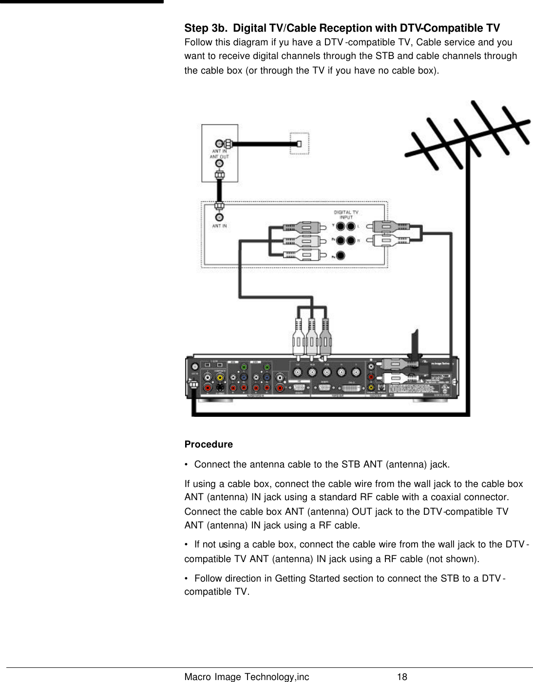   Macro Image Technology,inc          18  Step 3b.  Digital TV/Cable Reception with DTV-Compatible TV Follow this diagram if yu have a DTV -compatible TV, Cable service and you want to receive digital channels through the STB and cable channels through the cable box (or through the TV if you have no cable box).  Procedure •  Connect the antenna cable to the STB ANT (antenna) jack. If using a cable box, connect the cable wire from the wall jack to the cable box ANT (antenna) IN jack using a standard RF cable with a coaxial connector.  Connect the cable box ANT (antenna) OUT jack to the DTV-compatible TV ANT (antenna) IN jack using a RF cable. •  If not using a cable box, connect the cable wire from the wall jack to the DTV -compatible TV ANT (antenna) IN jack using a RF cable (not shown). •  Follow direction in Getting Started section to connect the STB to a DTV -compatible TV.    