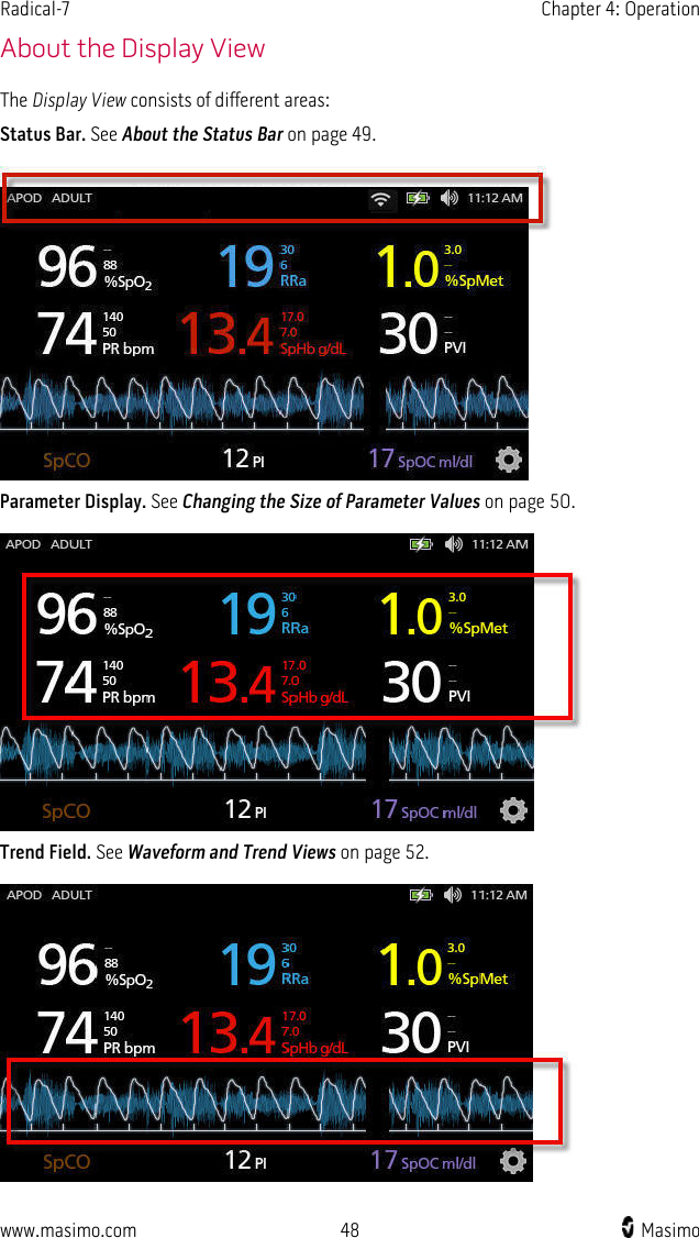 Radical-7   Chapter 4: Operation  www.masimo.com 48   Masimo    About the Display View The Display View consists of different areas: Status Bar. See About the Status Bar on page 49.   Parameter Display. See Changing the Size of Parameter Values on page 50.   Trend Field. See Waveform and Trend Views on page 52.   