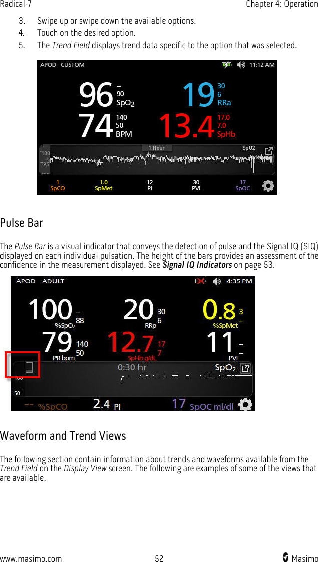 Radical-7   Chapter 4: Operation  www.masimo.com 52    Masimo    3. Swipe up or swipe down the available options. 4. Touch on the desired option. 5. The Trend Field displays trend data specific to the option that was selected.    Pulse Bar The Pulse Bar is a visual indicator that conveys the detection of pulse and the Signal IQ (SIQ) displayed on each individual pulsation. The height of the bars provides an assessment of the confidence in the measurement displayed. See Signal IQ Indicators on page 53.   Waveform and Trend Views The following section contain information about trends and waveforms available from the Trend Field on the Display View screen. The following are examples of some of the views that are available.  