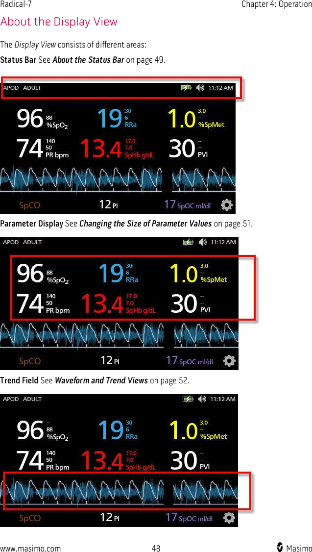 Radical-7    Chapter 4: Operation  www.masimo.com  48    Masimo    About the Display View The Display View consists of different areas: Status Bar See About the Status Bar on page 49.   Parameter Display See Changing the Size of Parameter Values on page 51.   Trend Field See Waveform and Trend Views on page 52.   