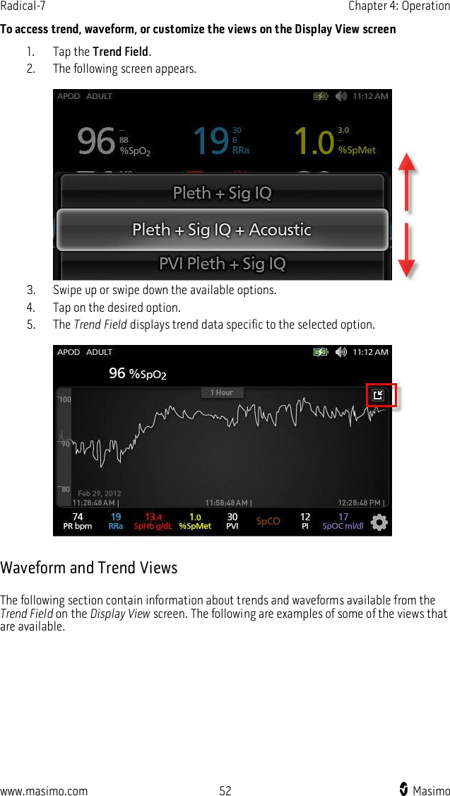 Radical-7    Chapter 4: Operation  www.masimo.com  52    Masimo    To access trend, waveform, or customize the views on the Display View screen 1. Tap the Trend Field. 2. The following screen appears.   3. Swipe up or swipe down the available options. 4. Tap on the desired option. 5. The Trend Field displays trend data specific to the selected option.    Waveform and Trend Views The following section contain information about trends and waveforms available from the Trend Field on the Display View screen. The following are examples of some of the views that are available.  