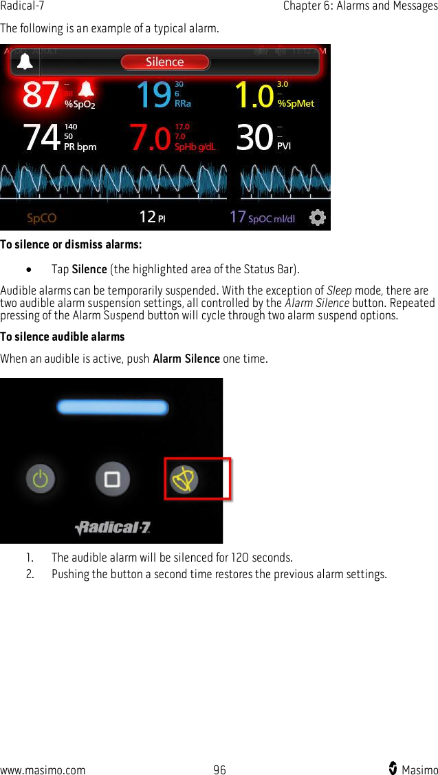 Radical-7    Chapter 6: Alarms and Messages  www.masimo.com  96    Masimo    The following is an example of a typical alarm.  To silence or dismiss alarms:  Tap Silence (the highlighted area of the Status Bar). Audible alarms can be temporarily suspended. With the exception of Sleep mode, there are two audible alarm suspension settings, all controlled by the Alarm Silence button. Repeated pressing of the Alarm Suspend button will cycle through two alarm suspend options. To silence audible alarms When an audible is active, push Alarm Silence one time.     1. The audible alarm will be silenced for 120 seconds. 2. Pushing the button a second time restores the previous alarm settings.   