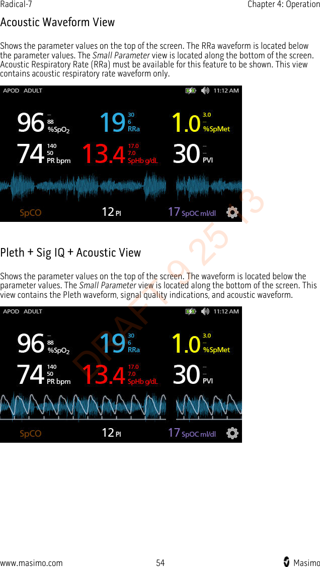 Radical-7    Chapter 4: Operation  Acoustic Waveform View Shows the parameter values on the top of the screen. The RRa waveform is located below the parameter values. The Small Parameter view is located along the bottom of the screen. Acoustic Respiratory Rate (RRa) must be available for this feature to be shown. This view contains acoustic respiratory rate waveform only.   Pleth + Sig IQ + Acoustic View Shows the parameter values on the top of the screen. The waveform is located below the parameter values. The Small Parameter view is located along the bottom of the screen. This view contains the Pleth waveform, signal quality indications, and acoustic waveform.   www.masimo.com 54    Masimo    DRAFT 9 25 13