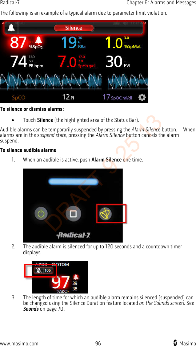 Radical-7    Chapter 6: Alarms and Messages  The following is an example of a typical alarm due to parameter limit violation.  To silence or dismiss alarms: • Touch Silence (the highlighted area of the Status Bar). Audible alarms can be temporarily suspended by pressing the Alarm Silence button.  When alarms are in the suspend state, pressing the Alarm Silence button cancels the alarm suspend. To silence audible alarms 1. When an audible is active, push Alarm Silence one time.     2. The audible alarm is silenced for up to 120 seconds and a countdown timer displays.   3. The length of time for which an audible alarm remains silenced (suspended) can be changed using the Silence Duration feature located on the Sounds screen. See Sounds on page 70.   www.masimo.com 96    Masimo    DRAFT 9 25 13