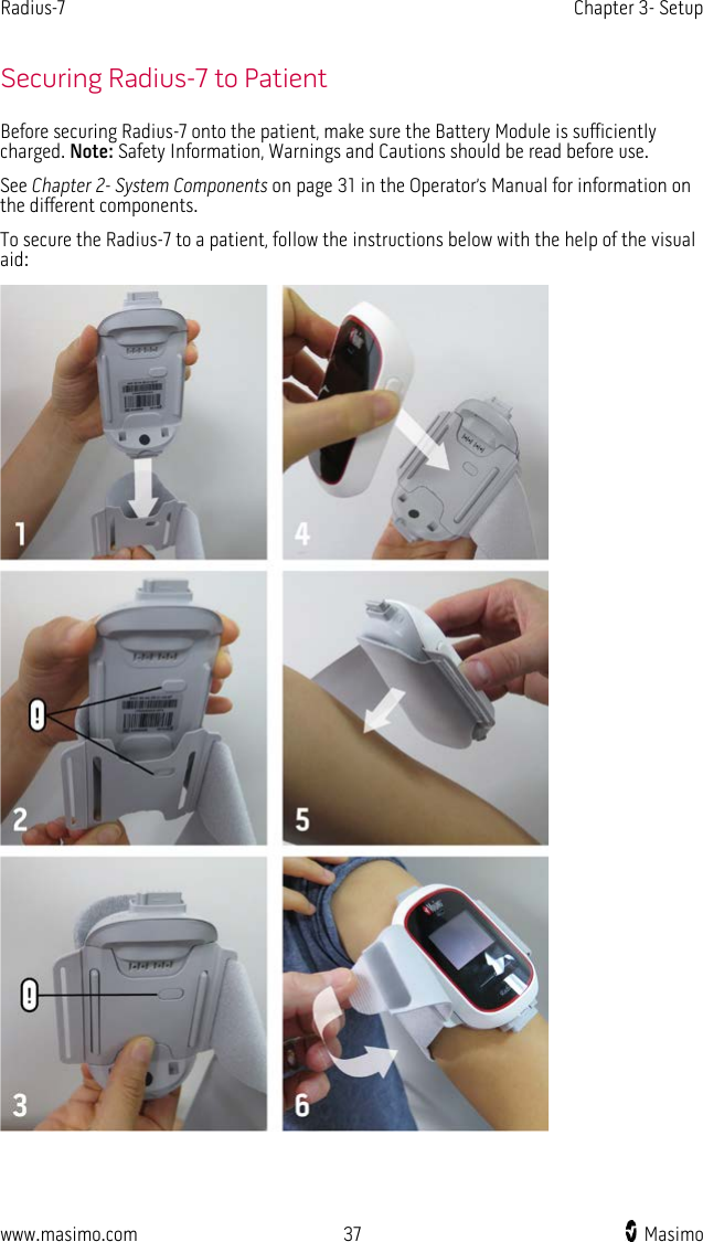 Radius-7   Chapter 3- Setup  www.masimo.com 37    Masimo    Securing Radius-7 to Patient Before securing Radius-7 onto the patient, make sure the Battery Module is sufficiently charged. Note: Safety Information, Warnings and Cautions should be read before use.   See Chapter 2- System Components on page 31 in the Operator’s Manual for information on the different components.   To secure the Radius-7 to a patient, follow the instructions below with the help of the visual aid:  