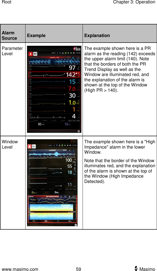 Root    Chapter 3: Operation  www.masimo.com  59    Masimo     Alarm Source Example Explanation Parameter Level  The example shown here is a PR alarm as the reading (142) exceeds the upper alarm limit (140). Note that the borders of both the PR Trend Display as well as the Window are illuminated red, and the explanation of the alarm is shown at the top of the Window (High PR &gt; 140). Window Level  The example shown here is a &quot;High Impedance&quot; alarm in the lower Window.   Note that the border of the Window illuminates red, and the explanation of the alarm is shown at the top of the Window (High Impedance Detected). 