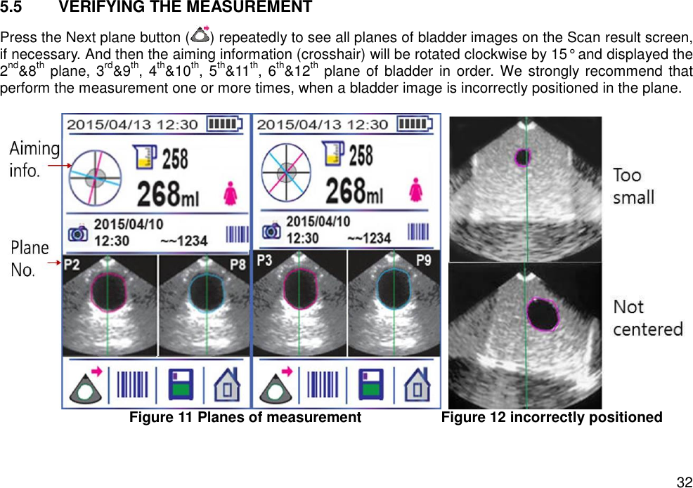   32 5.5  VERIFYING THE MEASUREMENT   Press the Next plane button ( ) repeatedly to see all planes of bladder images on the Scan result screen, if necessary. And then the aiming information (crosshair) will be rotated clockwise by 15° and displayed the 2nd&amp;8th plane, 3rd&amp;9th, 4th&amp;10th, 5th&amp;11th, 6th&amp;12th plane of bladder in order. We strongly recommend that perform the measurement one or more times, when a bladder image is incorrectly positioned in the plane.       Figure 11 Planes of measurement                      Figure 12 incorrectly positioned    