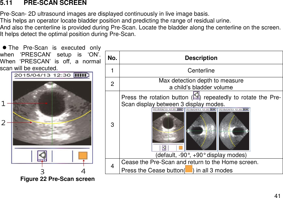   41 5.11  PRE-SCAN SCREEN Pre-Scan- 2D ultrasound images are displayed continuously in live image basis.   This helps an operator locate bladder position and predicting the range of residual urine. And also the centerline is provided during Pre-Scan. Locate the bladder along the centerline on the screen. It helps detect the optimal position during Pre-Scan.   The  Pre-Scan  is  executed  only                       when  ‘PRESCAN’  setup  is  ‘ON’. When  ‘PRESCAN’  is  off,  a  normal scan will be executed.  Figure 22 Pre-Scan screen   No. Description 1 Centerline   2 Max detection depth to measure   a child’s bladder volume 3 Press the rotation  button ( ) repeatedly to rotate the  Pre-Scan display between 3 display modes.  (default, -90°, +90° display modes) 4 Cease the Pre-Scan and return to the Home screen. Press the Cease button( ) in all 3 modes 