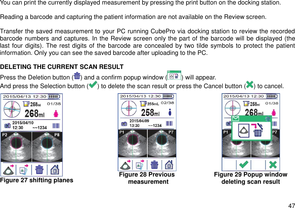   47 You can print the currently displayed measurement by pressing the print button on the docking station.    Reading a barcode and capturing the patient information are not available on the Review screen.    Transfer the saved measurement to your PC running CubePro via docking station to review the recorded barcode numbers and captures. In the Review screen only the part of the barcode will be displayed (the last four digits). The rest digits of the barcode are concealed by two tilde symbols to protect the patient information. Only you can see the saved barcode after uploading to the PC.    DELETING THE CURRENT SCAN RESULT   Press the Deletion button ( ) and a confirm popup window ( ) will appear. And press the Selection button ( ) to delete the scan result or press the Cancel button ( ) to cancel.  Figure 27 shifting planes  Figure 28 Previous   measurement  Figure 29 Popup window     deleting scan result    