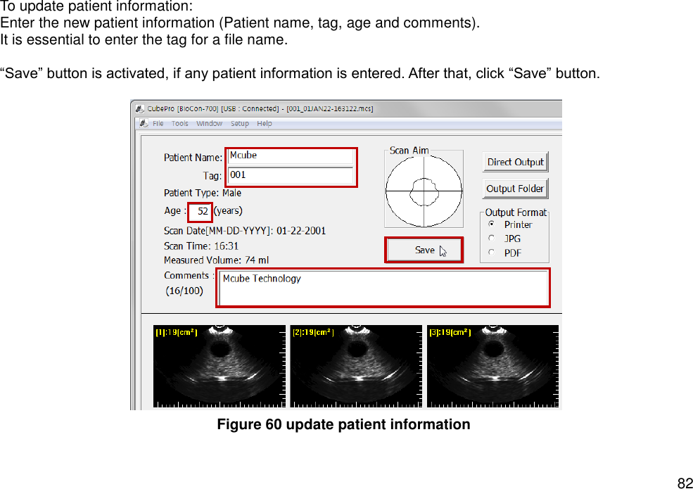   82 To update patient information:   Enter the new patient information (Patient name, tag, age and comments).   It is essential to enter the tag for a file name.    “Save” button is activated, if any patient information is entered. After that, click “Save” button.              Figure 60 update patient information 