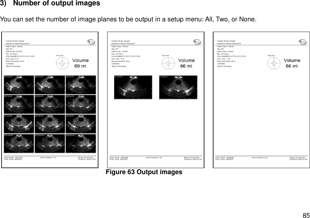   85 3)  Number of output images    You can set the number of image planes to be output in a setup menu: All, Two, or None.      Figure 63 Output images         