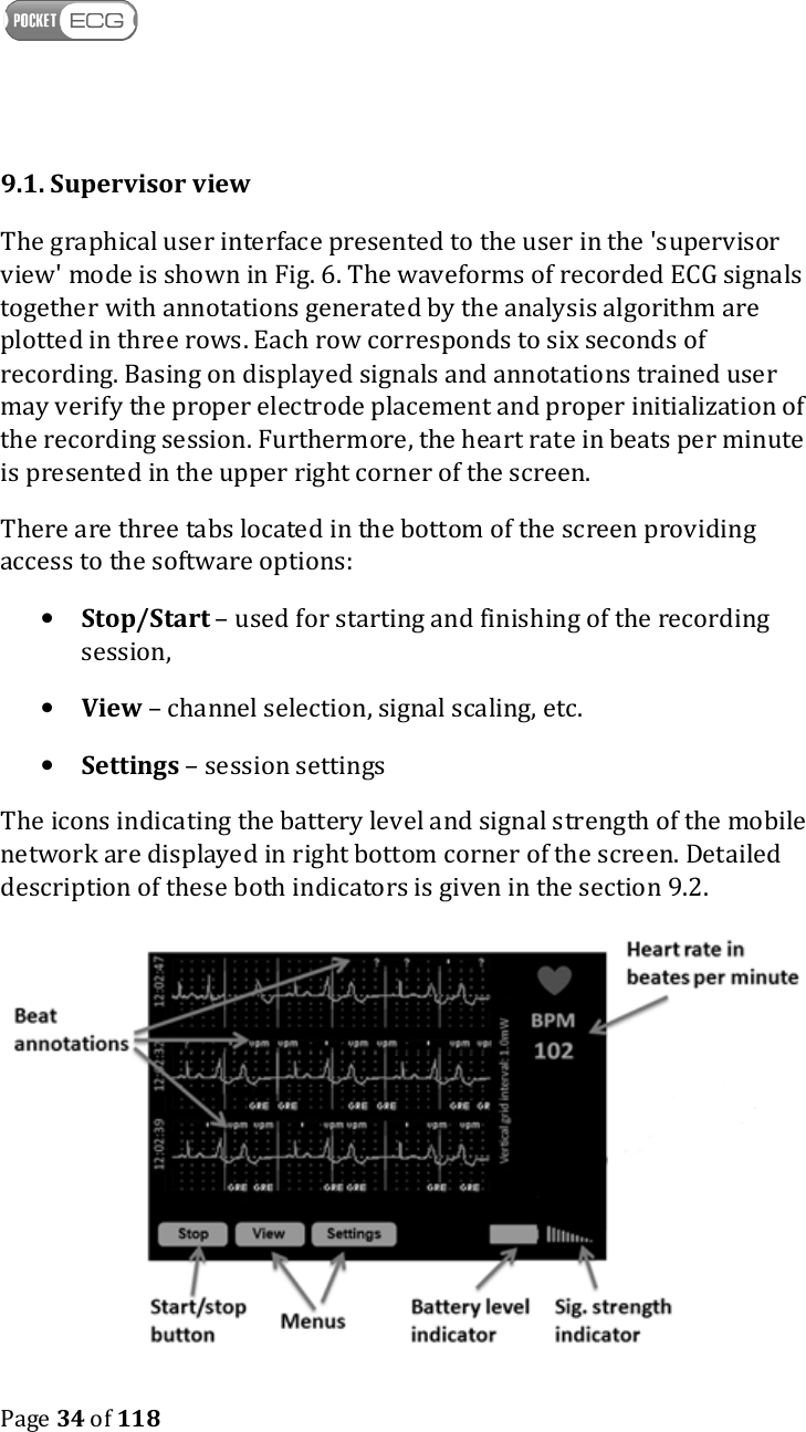    Page 34 of 118  9.1. Supervisor view The graphical user interface presented to the user in the &apos;supervisor view&apos; mode is shown in Fig. 6. The waveforms of recorded ECG signals together with annotations generated by the analysis algorithm are plotted in three rows. Each row corresponds to six seconds of recording. Basing on displayed signals and annotations trained user may verify the proper electrode placement and proper initialization of the recording session. Furthermore, the heart rate in beats per minute is presented in the upper right corner of the screen.  There are three tabs located in the bottom of the screen providing access to the software options: • Stop/Start – used for starting and finishing of the recording session, • View – channel selection, signal scaling, etc. • Settings – session settings The icons indicating the battery level and signal strength of the mobile network are displayed in right bottom corner of the screen. Detailed description of these both indicators is given in the section 9.2.  