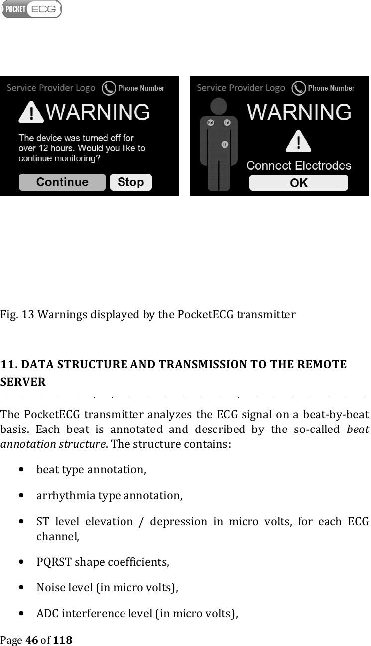    Page 46 of 118         Fig. 13 Warnings displayed by the PocketECG transmitter  11. DATA STRUCTURE AND TRANSMISSION TO THE REMOTE SERVER The PocketECG  transmitter analyzes the ECG signal on a beat-by-beat basis.  Each  beat  is  annotated  and  described  by  the  so-called  beat annotation structure. The structure contains: • beat type annotation, • arrhythmia type annotation, • ST  level  elevation  /  depression  in  micro  volts,  for  each  ECG channel, • PQRST shape coefficients, • Noise level (in micro volts), • ADC interference level (in micro volts), 