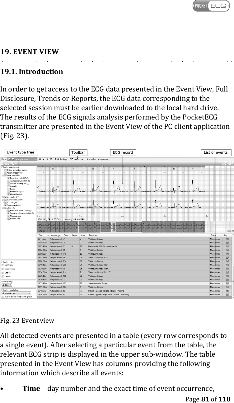    Page 81 of 118  19. EVENT VIEW 19.1. Introduction In order to get access to the ECG data presented in the Event View, Full Disclosure, Trends or Reports, the ECG data corresponding to the selected session must be earlier downloaded to the local hard drive. The results of the ECG signals analysis performed by the PocketECG transmitter are presented in the Event View of the PC client application (Fig. 23).  Fig. 23 Event view All detected events are presented in a table (every row corresponds to a single event). After selecting a particular event from the table, the relevant ECG strip is displayed in the upper sub-window. The table presented in the Event View has columns providing the following information which describe all events: •  Time – day number and the exact time of event occurrence,  
