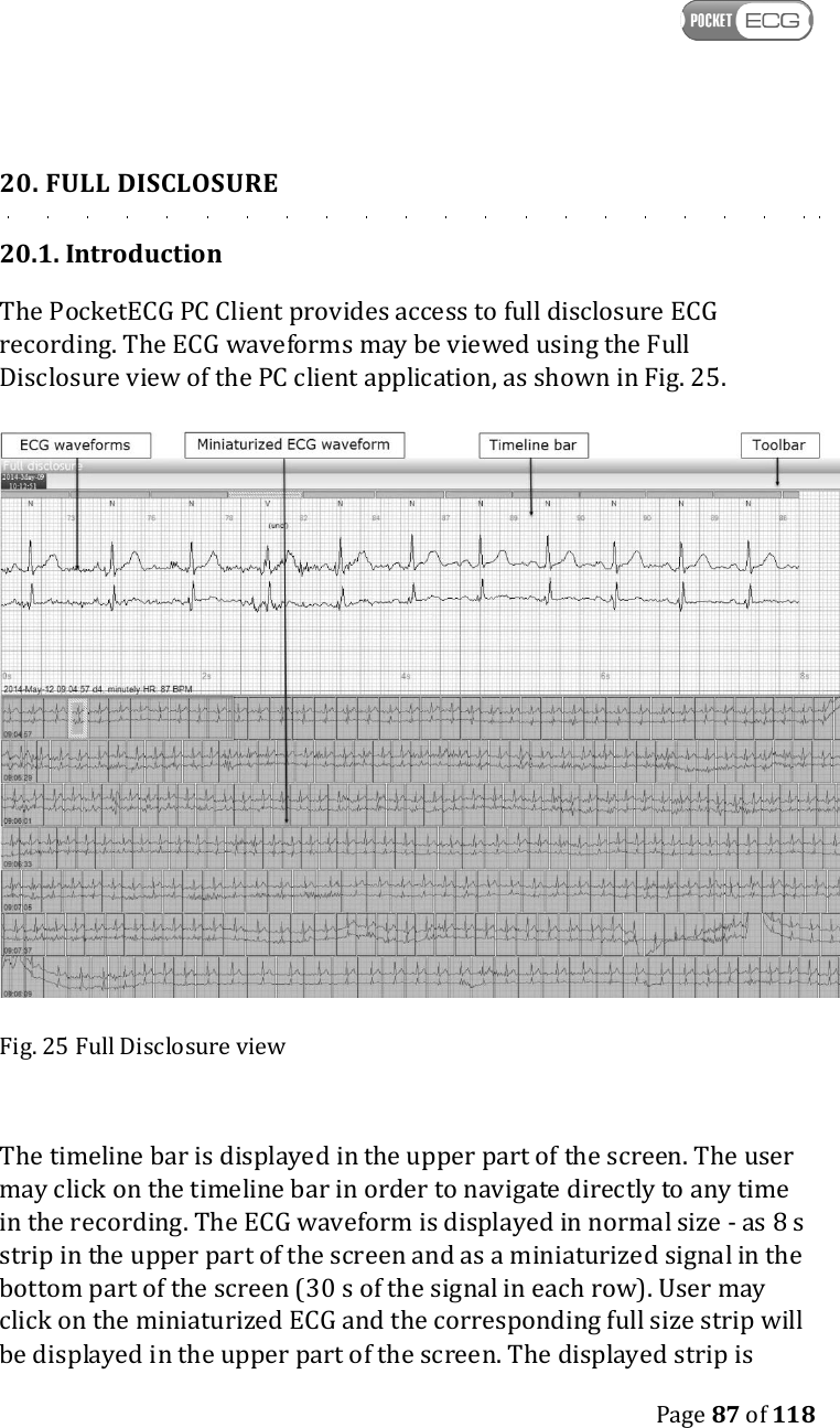    Page 87 of 118  20. FULL DISCLOSURE 20.1. Introduction The PocketECG PC Client provides access to full disclosure ECG recording. The ECG waveforms may be viewed using the Full Disclosure view of the PC client application, as shown in Fig. 25.  Fig. 25 Full Disclosure view  The timeline bar is displayed in the upper part of the screen. The user may click on the timeline bar in order to navigate directly to any time in the recording. The ECG waveform is displayed in normal size - as 8 s strip in the upper part of the screen and as a miniaturized signal in the bottom part of the screen (30 s of the signal in each row). User may click on the miniaturized ECG and the corresponding full size strip will be displayed in the upper part of the screen. The displayed strip is 