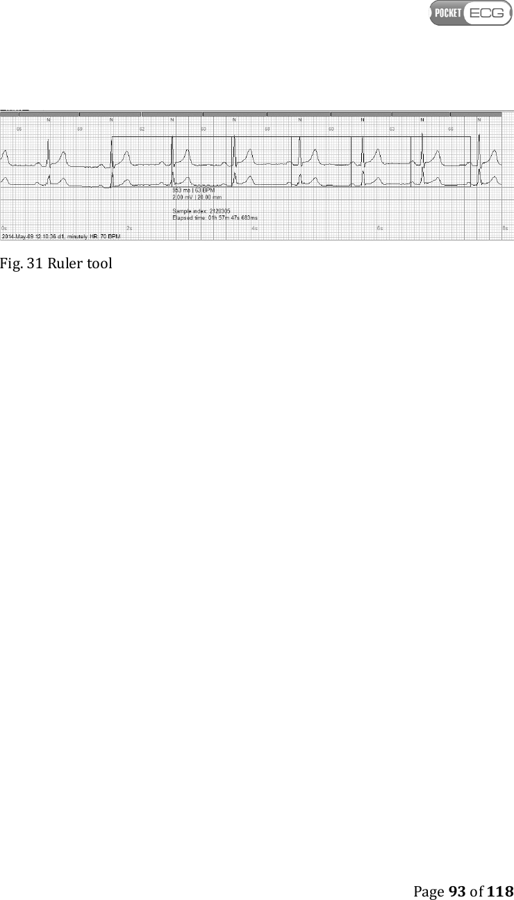    Page 93 of 118   Fig. 31 Ruler tool 