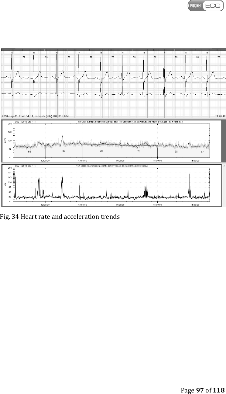    Page 97 of 118   Fig. 34 Heart rate and acceleration trends  