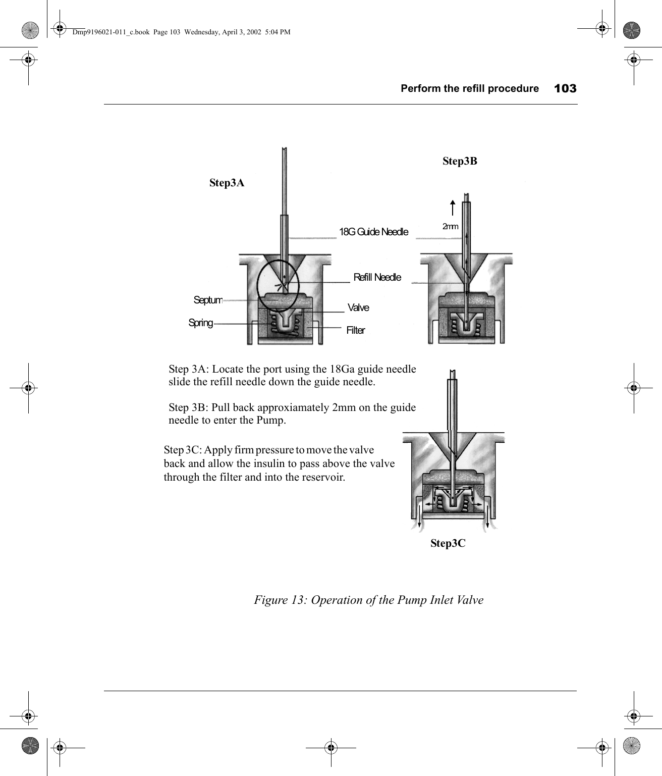 Perform the refill procedure 103Figure 13: Operation of the Pump Inlet Valve18G Guide NeedleRefill NeedleValveFilterSeptumSpring2mmSt e p  3 C:  A pp ly  fi r m  pr e s su re  t o m o ve  t h e  va lv e                back and allow the insulin to pass above the valve through the filter and into the reservoir.Step 3A: Locate the port using the 18Ga guide needleslide the refill needle down the guide needle.Step 3B: Pull back approxiamately 2mm on the guide needle to enter the Pump.Step3A            Step3B       Step3CDmp9196021-011_c.book  Page 103  Wednesday, April 3, 2002  5:04 PM
