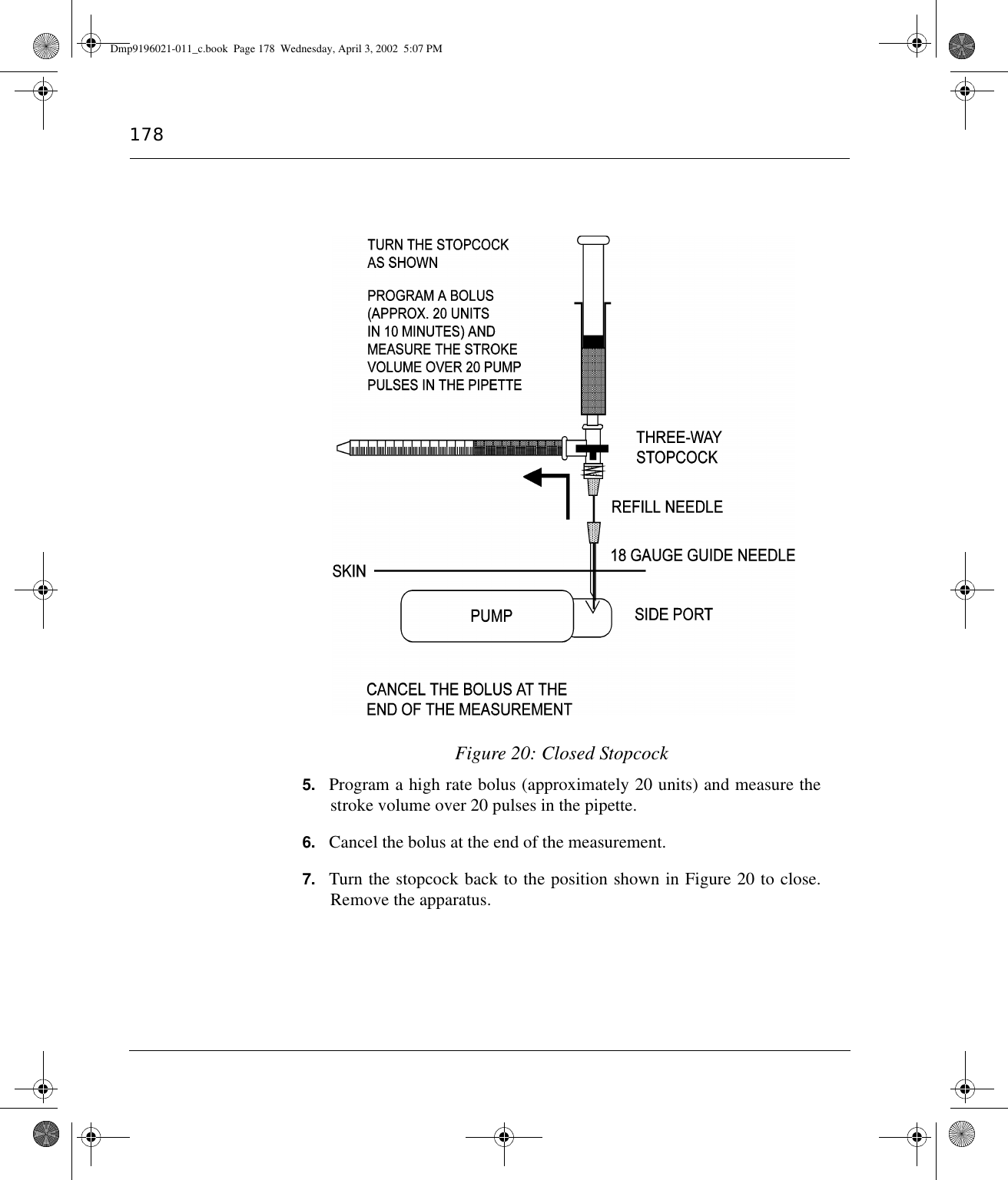 178Figure 20: Closed Stopcock5. Program a high rate bolus (approximately 20 units) and measure thestroke volume over 20 pulses in the pipette.6. Cancel the bolus at the end of the measurement.7. Turn the stopcock back to the position shown in Figure 20 to close.Remove the apparatus.Dmp9196021-011_c.book  Page 178  Wednesday, April 3, 2002  5:07 PM