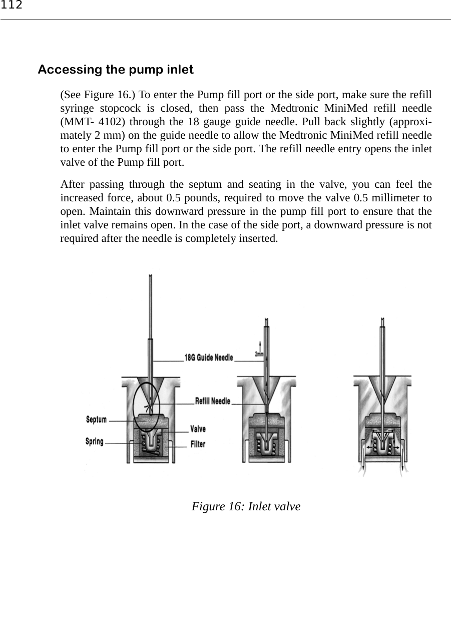 112Accessing the pump inlet(See Figure 16.) To enter the Pump fill port or the side port, make sure the refillsyringe stopcock is closed, then pass the Medtronic MiniMed refill needle(MMT- 4102) through the 18 gauge guide needle. Pull back slightly (approxi-mately 2 mm) on the guide needle to allow the Medtronic MiniMed refill needleto enter the Pump fill port or the side port. The refill needle entry opens the inletvalve of the Pump fill port.After passing through the septum and seating in the valve, you can feel theincreased force, about 0.5 pounds, required to move the valve 0.5 millimeter toopen. Maintain this downward pressure in the pump fill port to ensure that theinlet valve remains open. In the case of the side port, a downward pressure is notrequired after the needle is completely inserted.Figure 16: Inlet valve