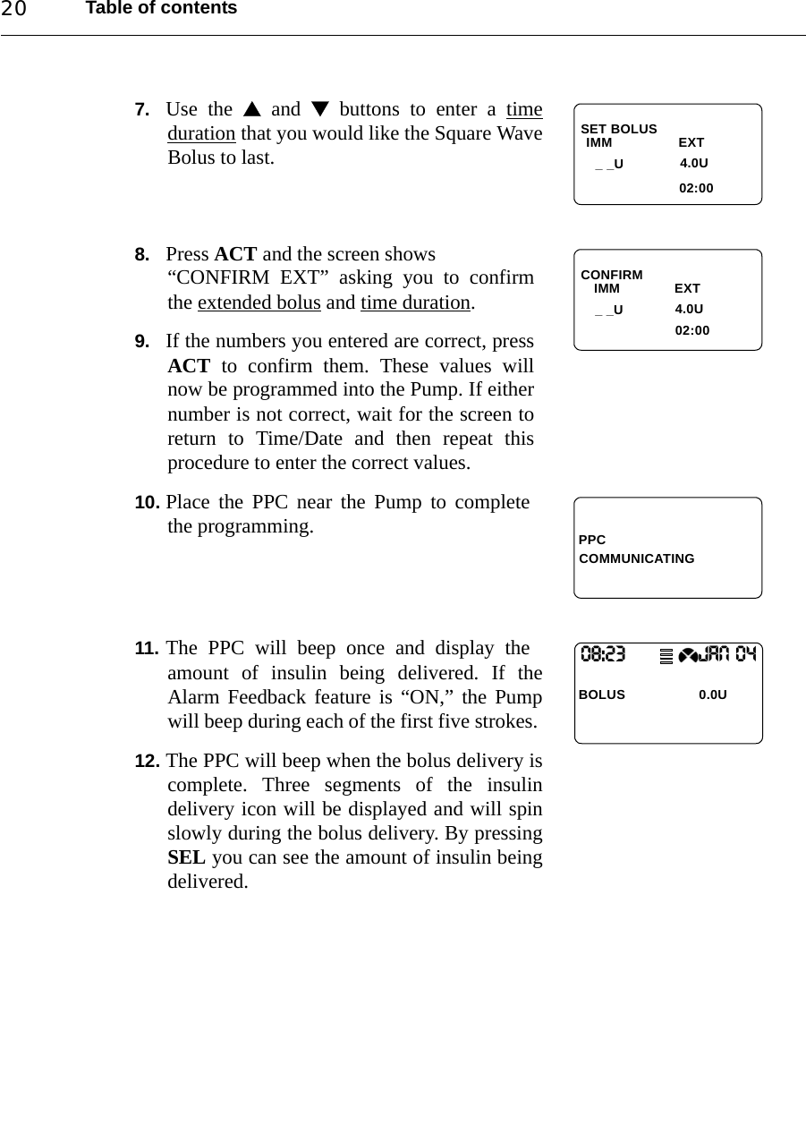 Table of contents207. Use the  and  buttons to enter a timeduration that you would like the Square WaveBolus to last.8. Press ACT and the screen shows “CONFIRM EXT” asking you to confirmthe extended bolus and time duration.9. If the numbers you entered are correct, pressACT to confirm them. These values willnow be programmed into the Pump. If eithernumber is not correct, wait for the screen toreturn to Time/Date and then repeat thisprocedure to enter the correct values.10. Place the PPC near the Pump to completethe programming.11. The PPC will beep once and display theamount of insulin being delivered. If theAlarm Feedback feature is “ON,” the Pumpwill beep during each of the first five strokes. 12. The PPC will beep when the bolus delivery iscomplete. Three segments of the insulindelivery icon will be displayed and will spinslowly during the bolus delivery. By pressingSEL you can see the amount of insulin beingdelivered.SET BOLUSIMM                 EXT 02:004.0U_ _UCONFIRM    IMM              EXT                                 02:00   4.0U_ _UPPCCOMMUNICATING08:23                   JAN 04BOLUS  0.0U