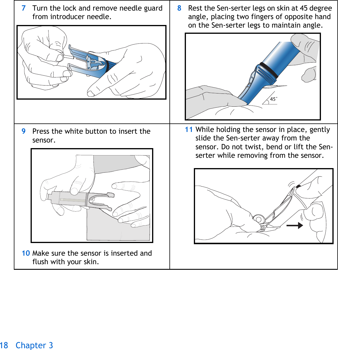 18 Chapter 3 7Turn the lock and remove needle guard from introducer needle.8Rest the Sen-serter legs on skin at 45 degree angle, placing two fingers of opposite hand on the Sen-serter legs to maintain angle.9Press the white button to insert the sensor. 10 Make sure the sensor is inserted and flush with your skin.11 While holding the sensor in place, gently slide the Sen-serter away from the sensor. Do not twist, bend or lift the Sen-serter while removing from the sensor.