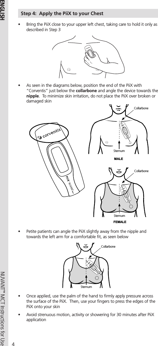 4NUVANT™ MCT Instructions for Use  ENGLISHStep 4:  Apply the PiiX to your Chest•  Bring the PiiX close to your upper left chest, taking care to hold it only as described in Step 3 •  As seen in the diagrams below, position the end of the PiiX with “Corventis” just below the collarbone and angle the device towards the nipple.  To minimize skin irritation, do not place the PiiX over broken or damaged skinSternumCollarboneMALESternumCollarboneMALESternumCollarboneFEMALE•  Petite patients can angle the PiiX slightly away from the nipple and towards the left arm for a comfortable ﬁt, as seen belowSternumCollarbone•  Once applied, use the palm of the hand to ﬁrmly apply pressure across the surface of the PiiX.  Then, use your ﬁngers to press the edges of the PiiX onto your skin•  Avoid strenuous motion, activity or showering for 30 minutes after PiiX application