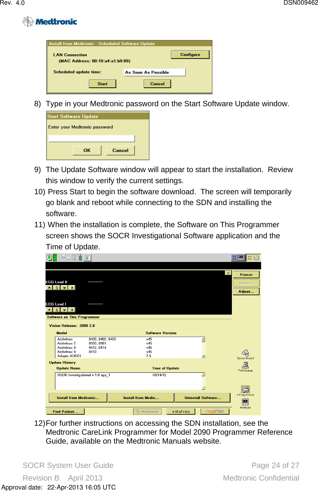 SOCR System User Guide Page 24 of 27Revision B    April 2013 Medtronic Confidential8) Type in your Medtronic password on the Start Software Update window.9) The Update Software window will appear to start the installation.  Review this window to verify the current settings.10) Press Start to begin the software download.  The screen will temporarily go blank and reboot while connecting to the SDN and installing the software. 11) When the installation is complete, the Software on This Programmer screen shows the SOCR Investigational Software application and the Time of Update.12)For further instructions on accessing the SDN installation, see the Medtronic CareLink Programmer for Model 2090 Programmer Reference Guide, available on the Medtronic Manuals website. Approval date:4.0 DSN00946222-Apr-2013 16:05 UTCRev.