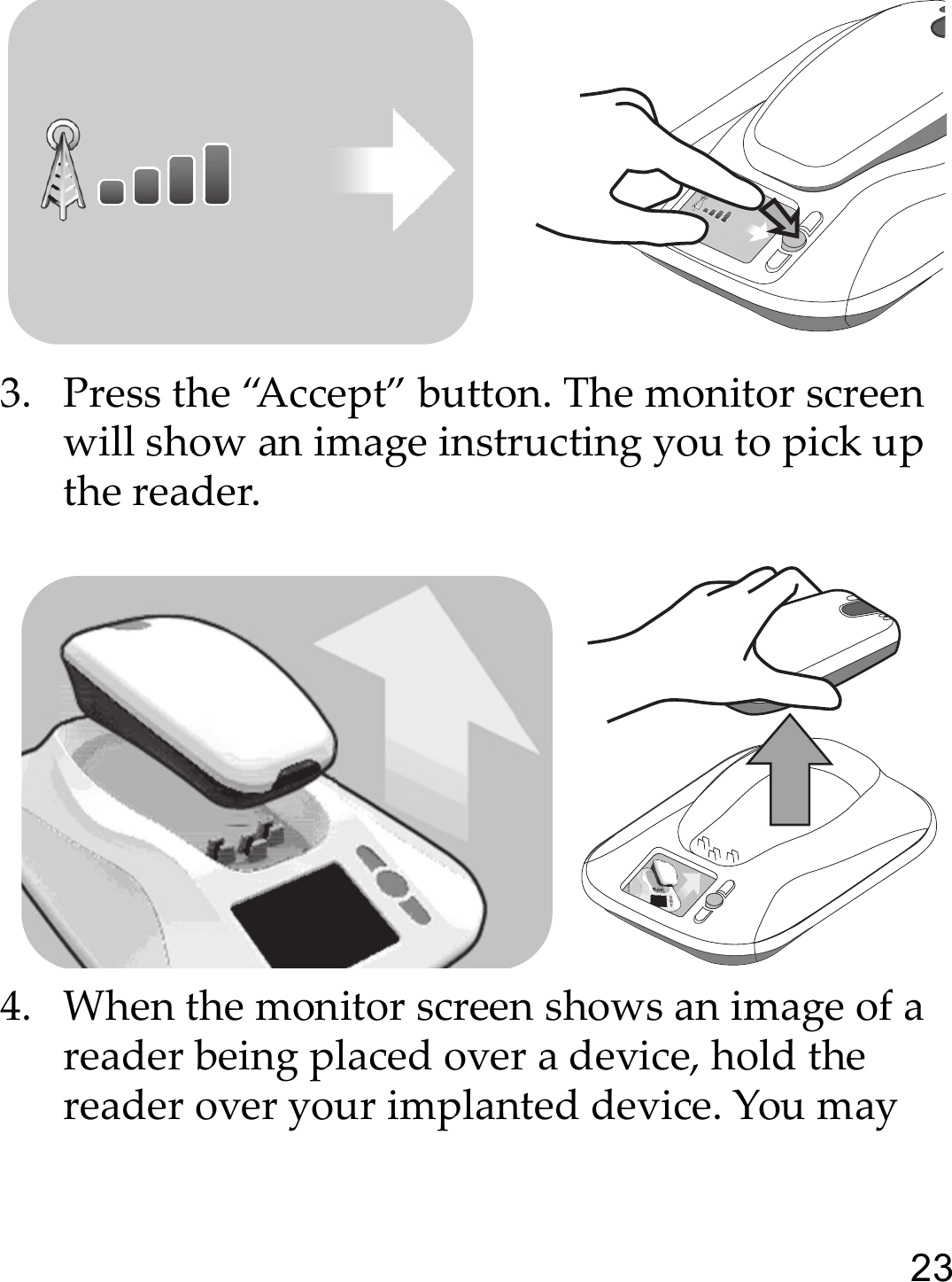 233. Press the “Accept” button. The monitor screen will show an image instructing you to pick up the reader.4. When the monitor screen shows an image of a reader being placed over a device, hold the reader over your implanted device. You may 